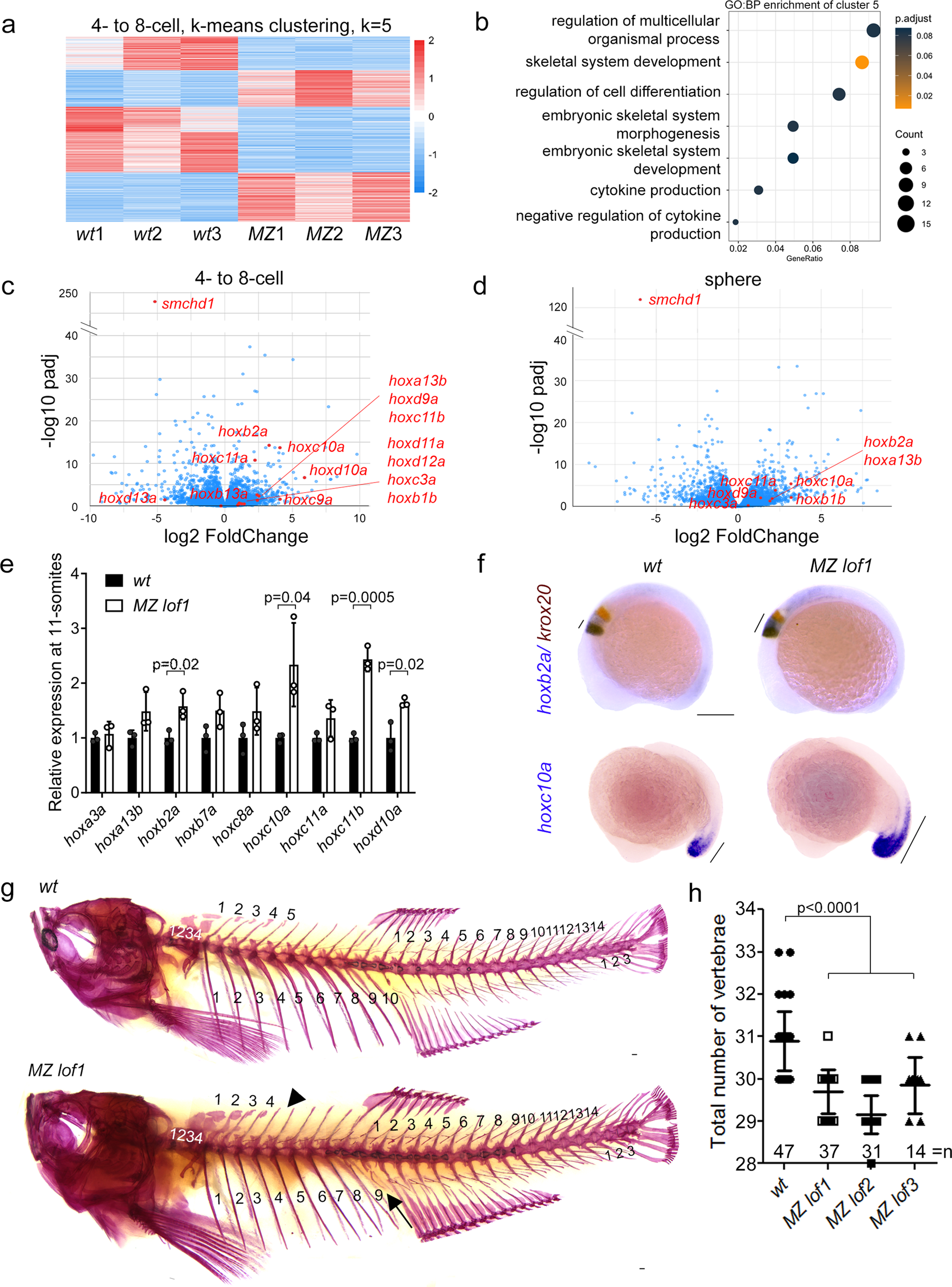 Fig. 2: MZ smchd1 fish embryos show derepression of hox genes and vertebral patterning defects.