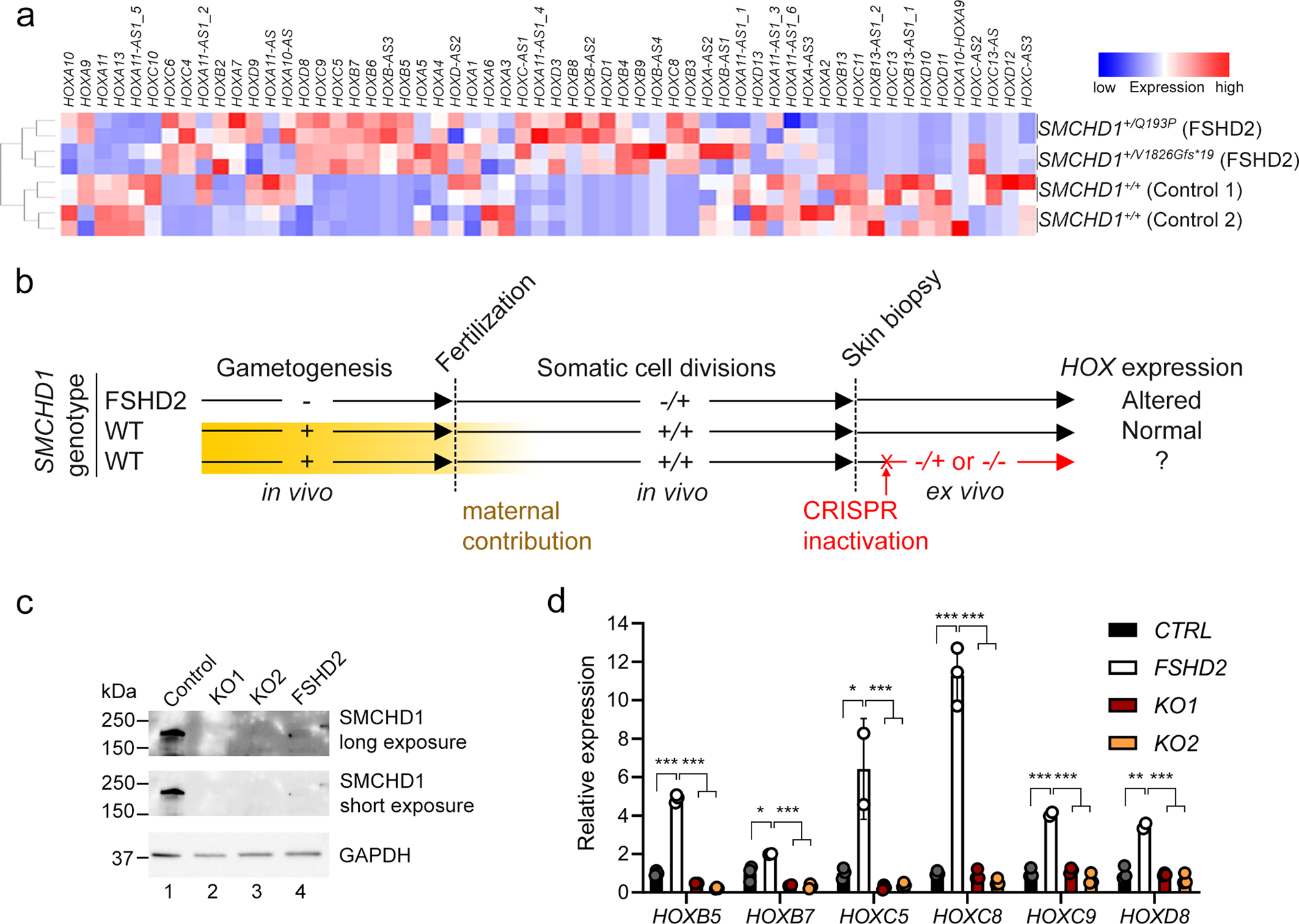 Fig. 6: Germline, but not adult, SMCHD1 deficiency leads to HOX dysregulation in human cutaneous fibroblasts.