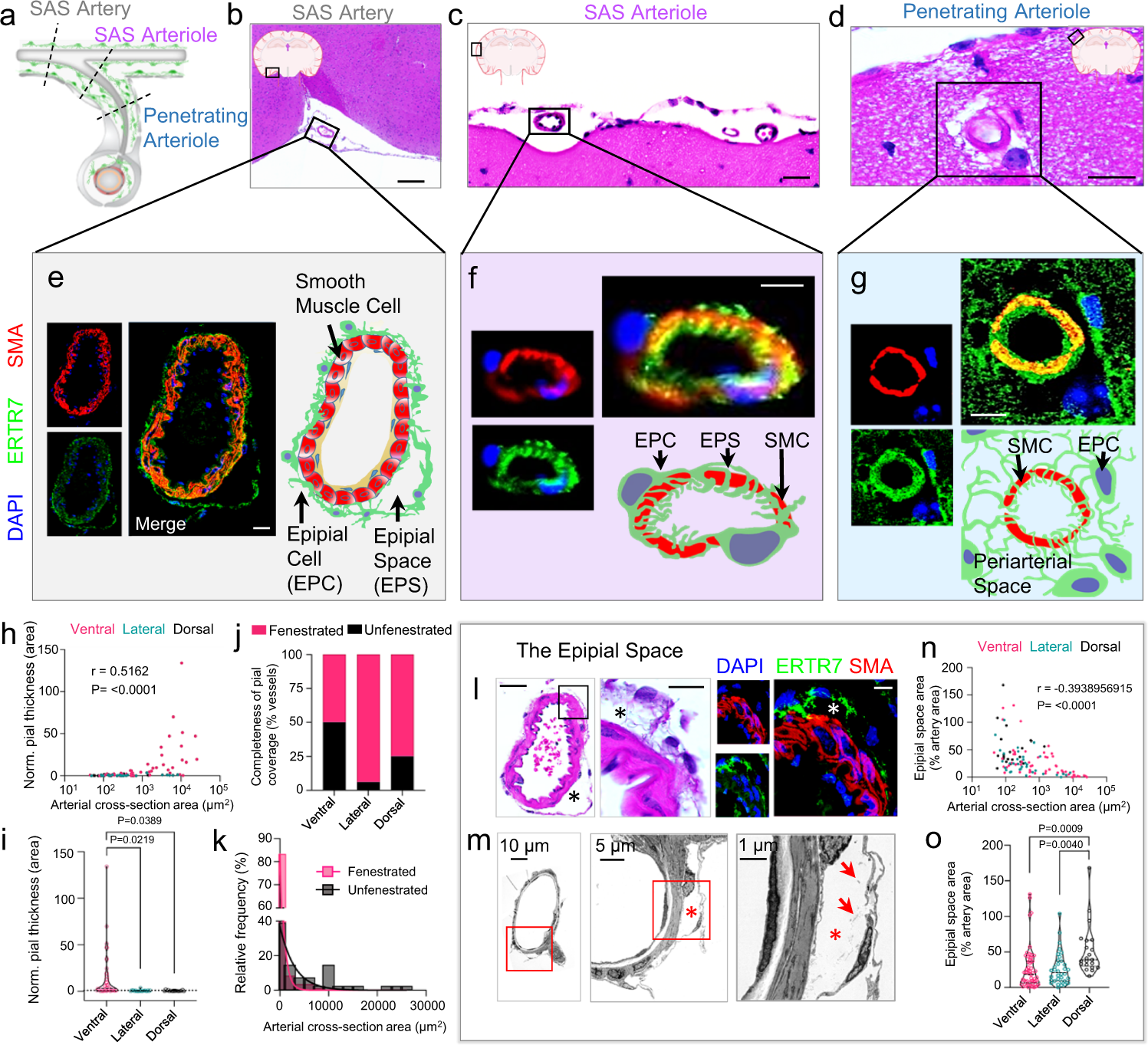 Fig. 2: The epipia attenuates and loosens around small-to-medium leptomeningeal arteries, forming the epipial space.