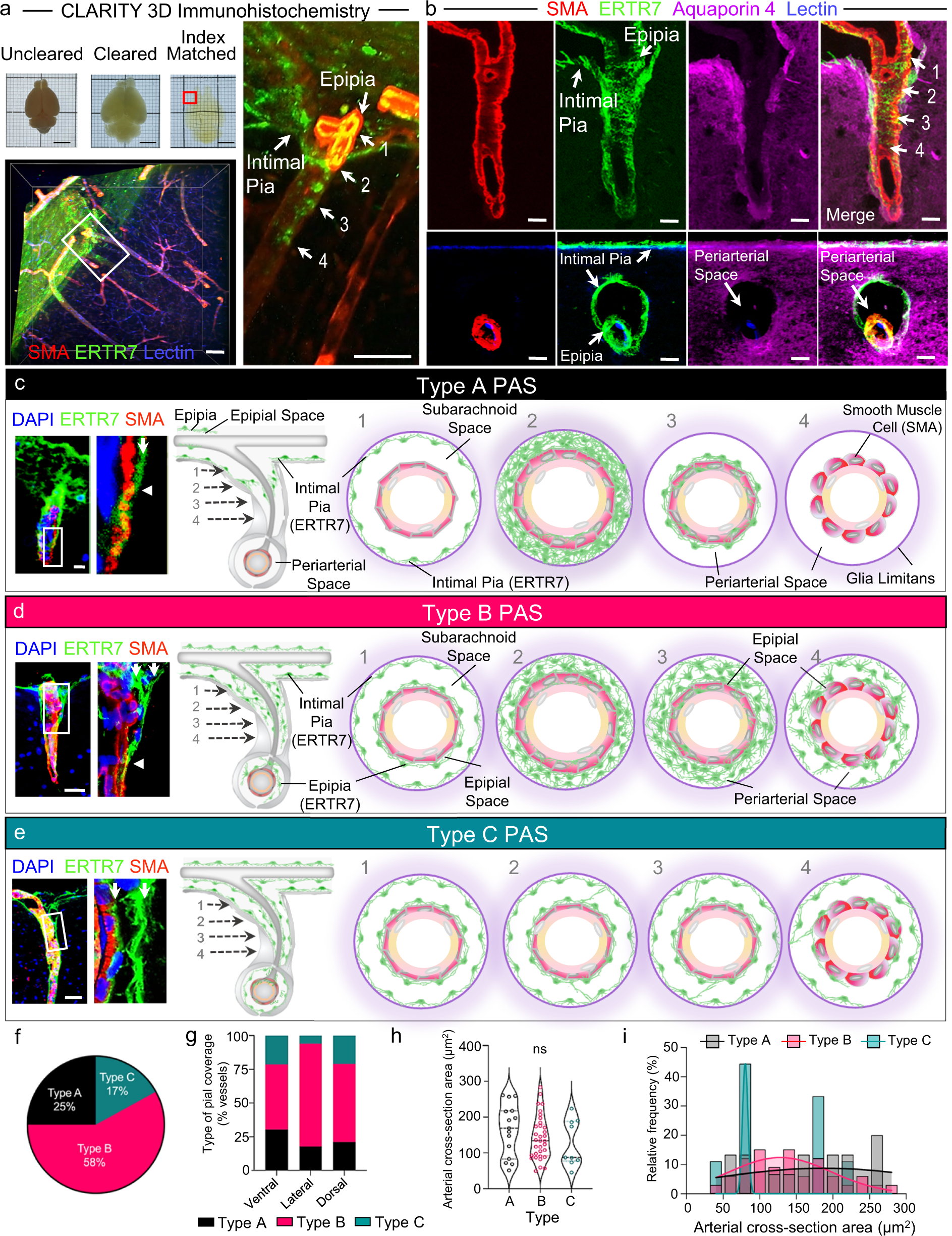 Fig. 3: Variability in intimal pial and epipial relationships give rise to distinct PAS architectures in superficial brain regions.