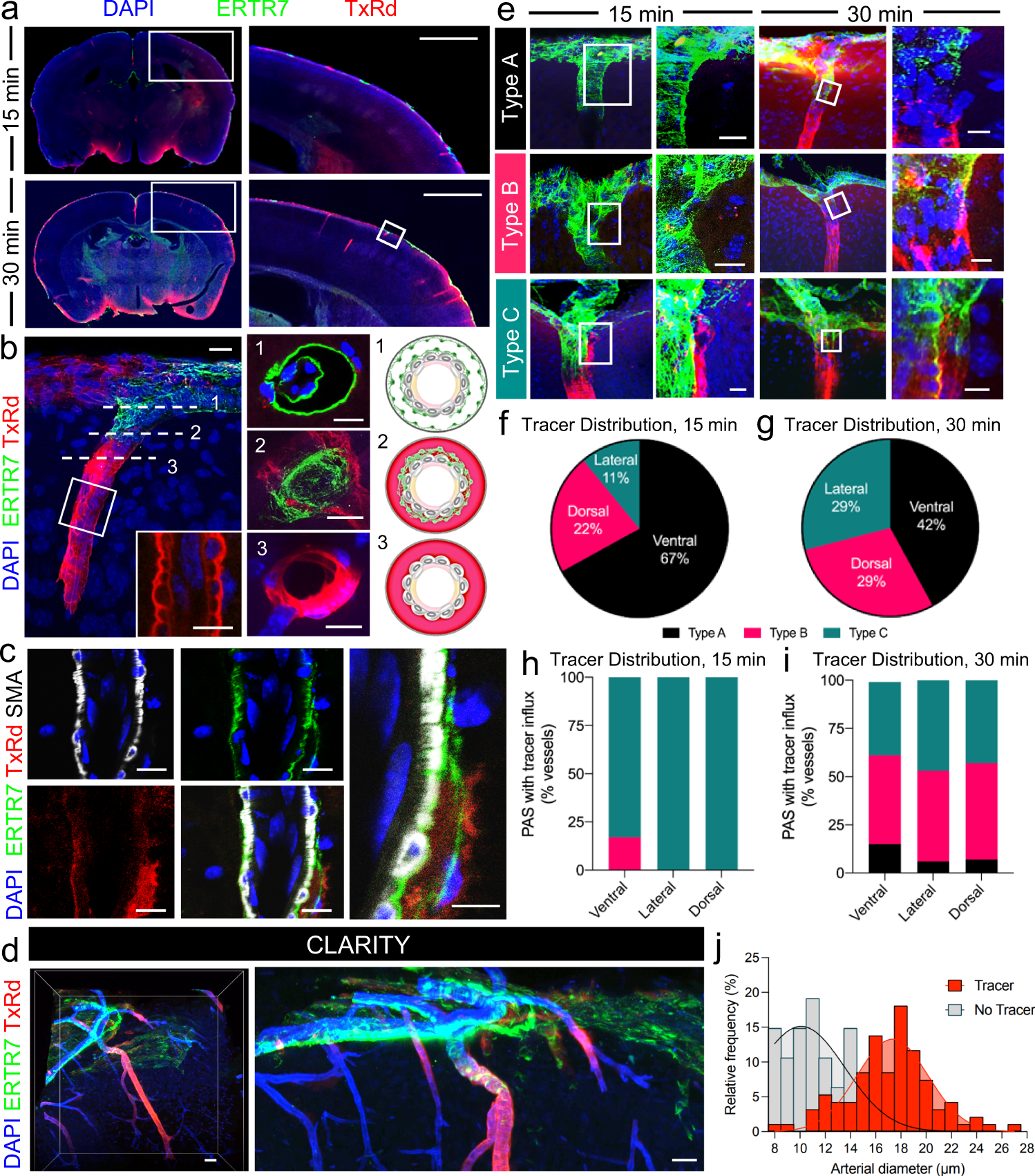 Fig. 4: Influx of CSF tracer is delayed, but not restricted across “covered” Type A and Type B PAS.
