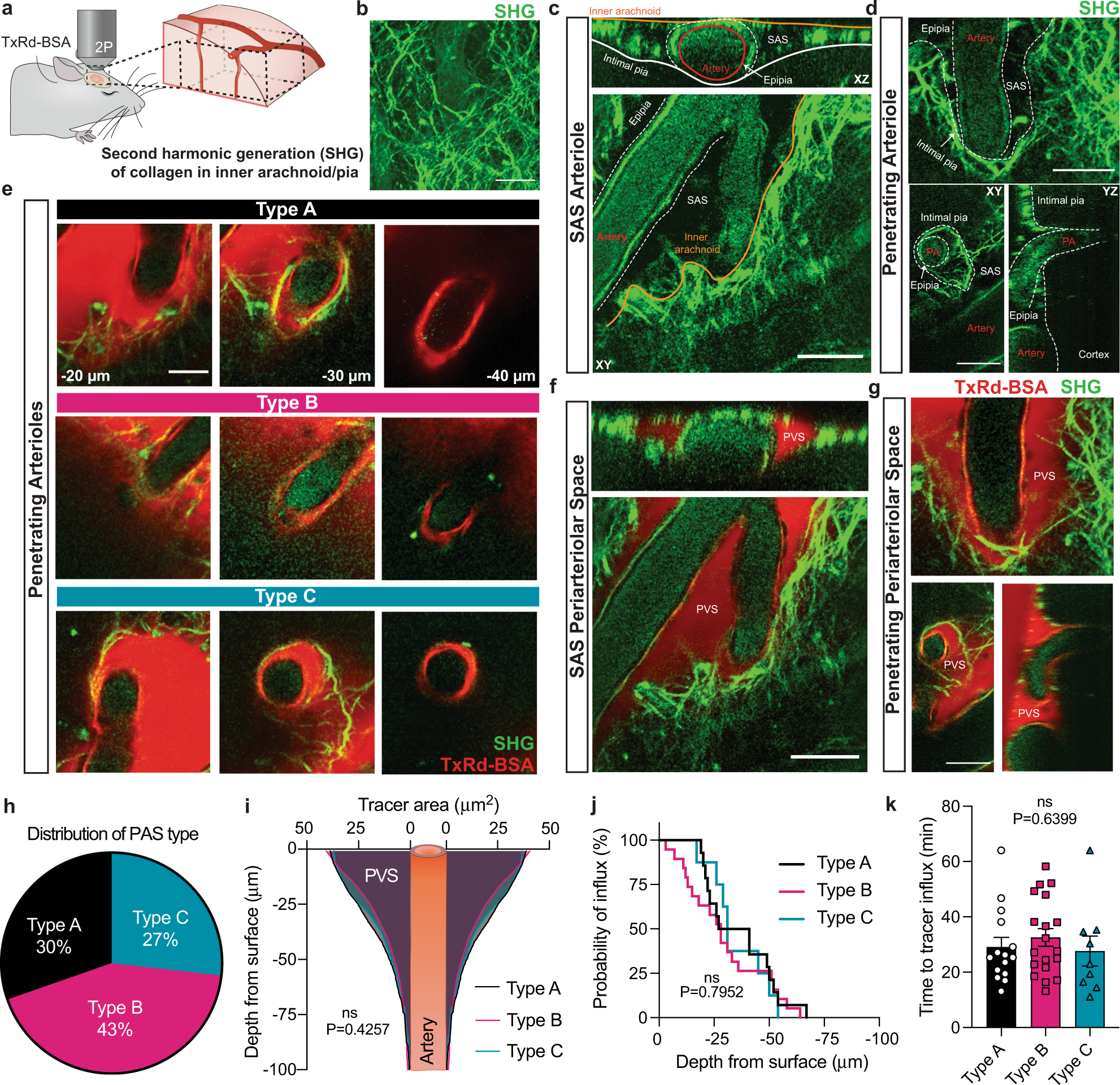 Fig. 5: The pia is not a barrier to CSF tracer transport (size 66 kDa), irrespective of periarteriolar space (PAS) type.