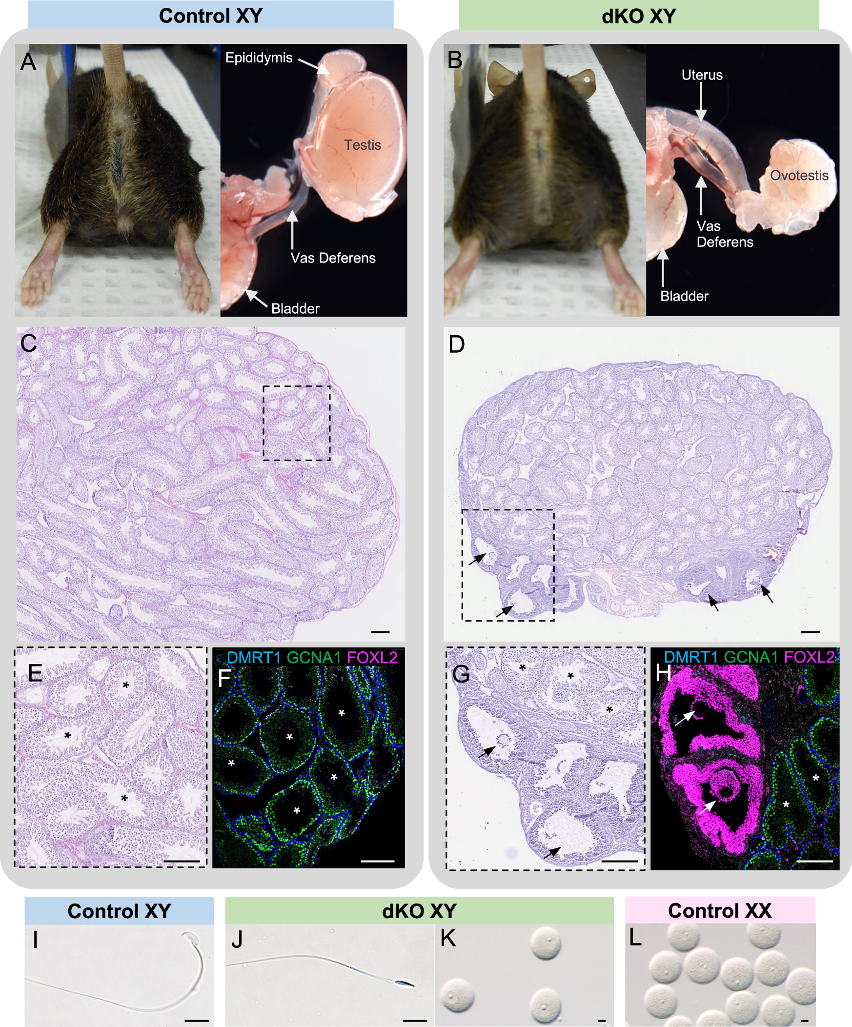 Somatic cell fate maintenance in mouse fetal testes via autocrine/paracrine  action of AMH and activin B | Nature Communications