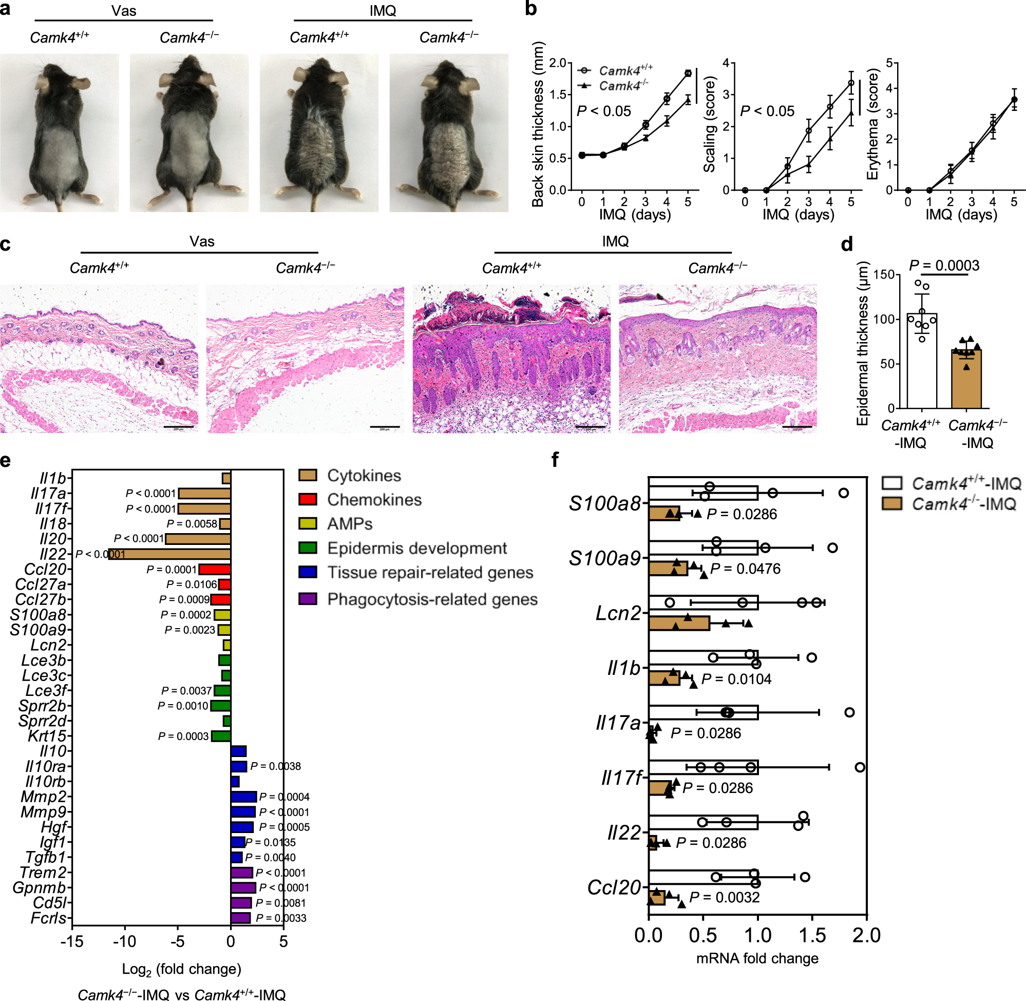 Fig. 2: Camk4 deficiency alleviates the severity of IMQ-induced psoriasis.