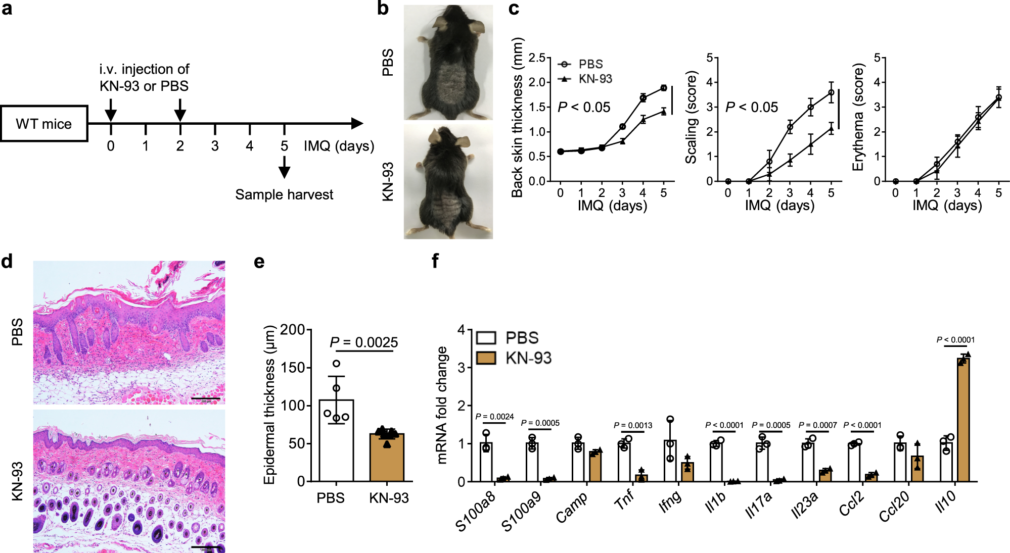 Fig. 9: CaMK4 inhibitor ameliorates IMQ-induced psoriasis.