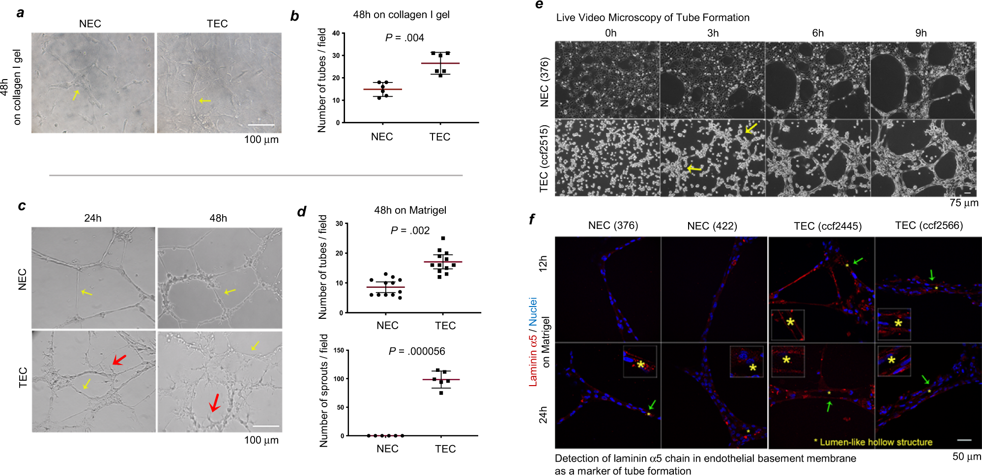 Integrin α3β1 promotes vessel formation of glioblastoma-associated  endothelial cells through calcium-mediated macropinocytosis and lysosomal  exocytosis | Nature Communications