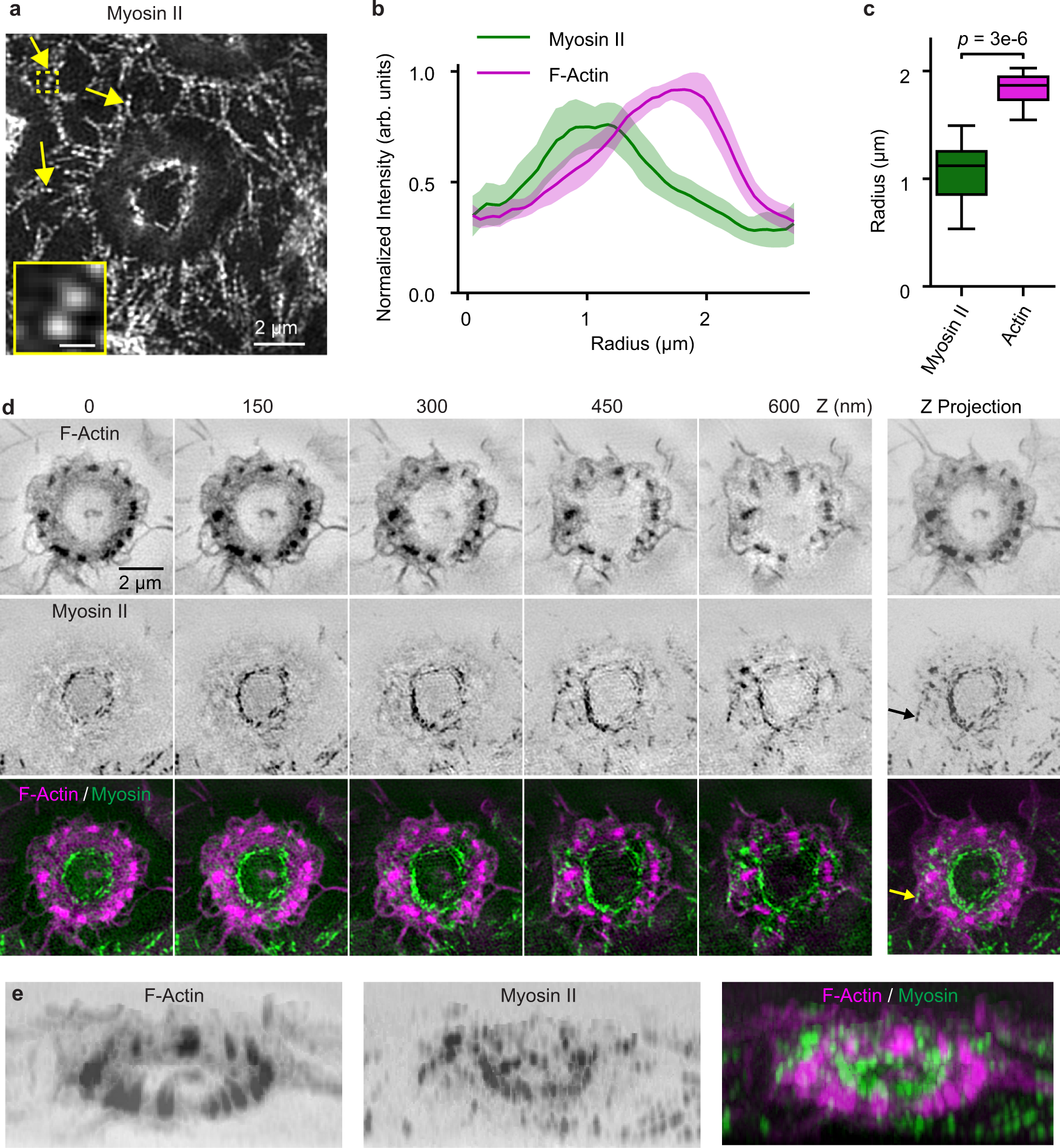 Fig. 8: Myosin II filaments in macrophage frustrated phagocytosis.