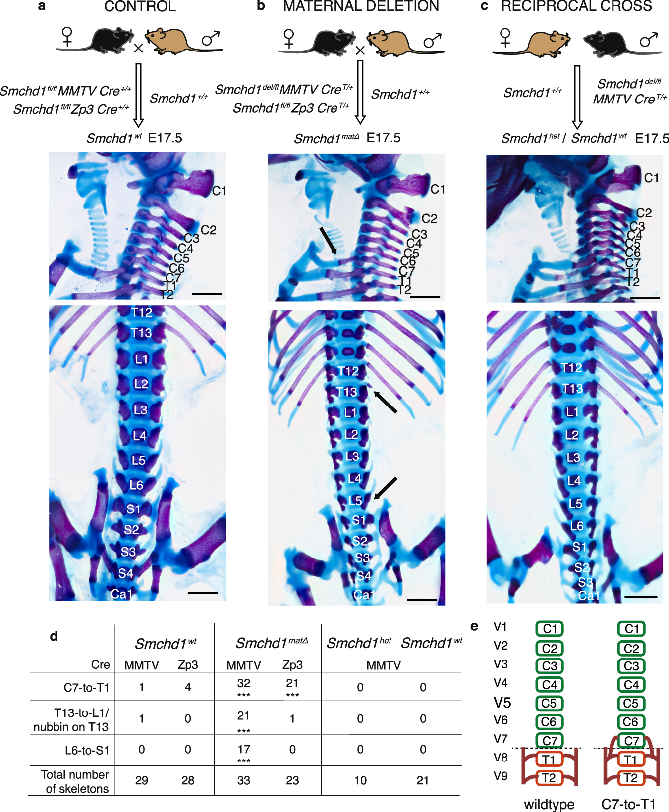 Fig. 1: Maternal SMCHD1 is required for normal skeletal patterning.