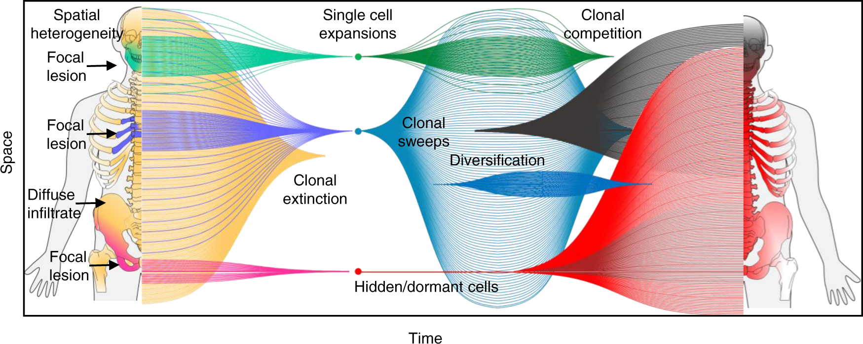 Fig. 8: Summary of the spatial-temporal evolution of multiple myeloma.