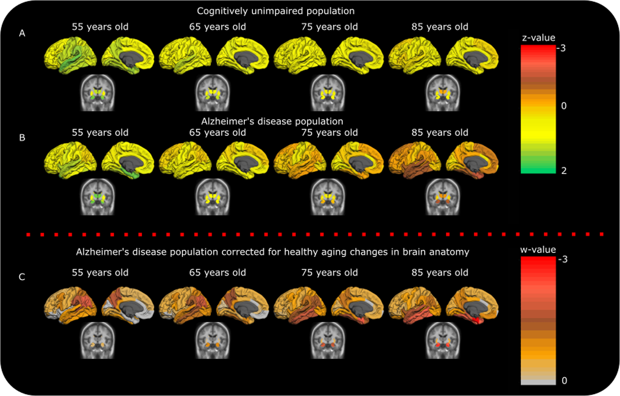 Fig. 1: Atrophy at population level in the CU and AD groups.