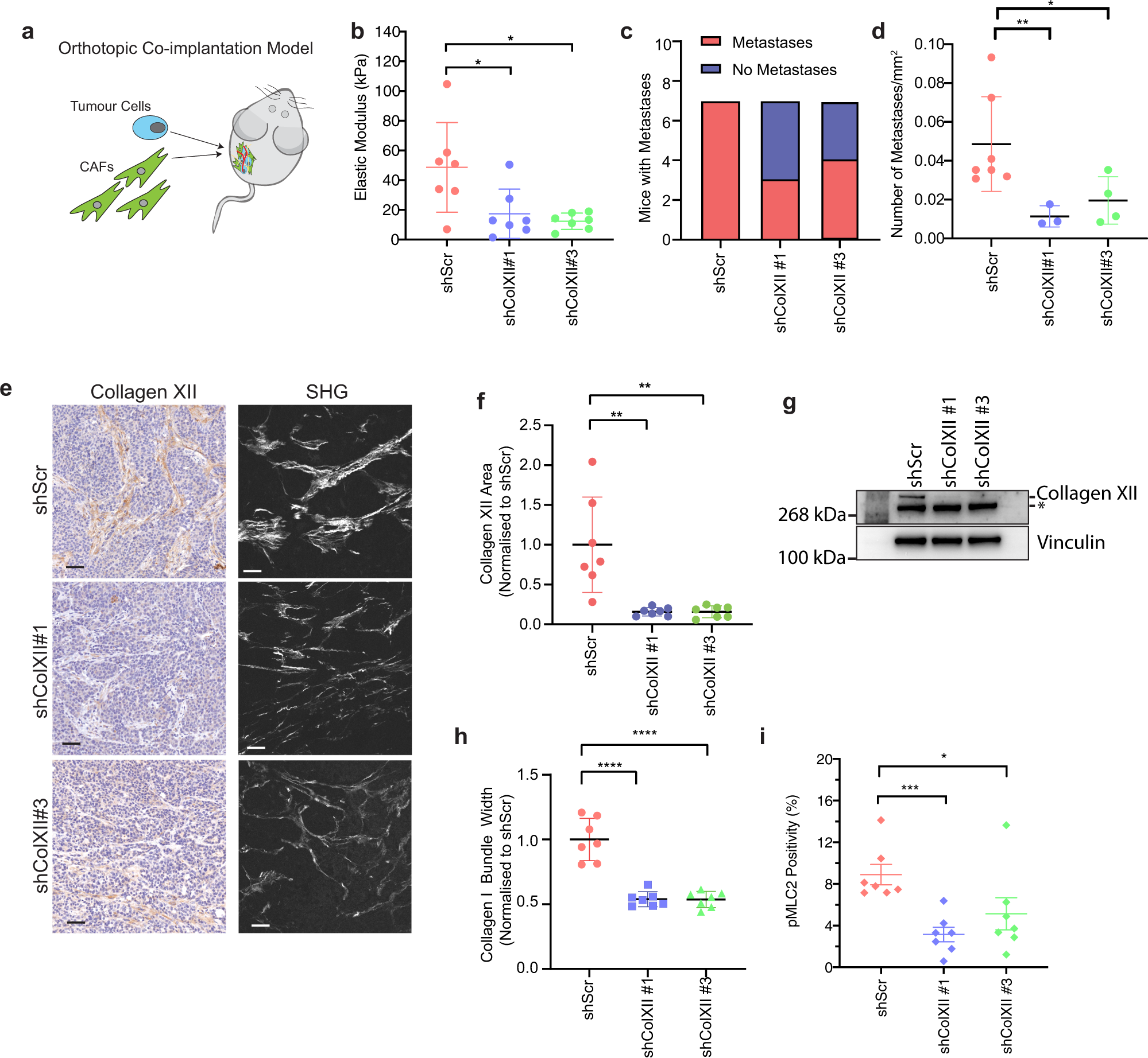 Fig. 8: Collagen XII knockdown reduces metastasis in vivo.