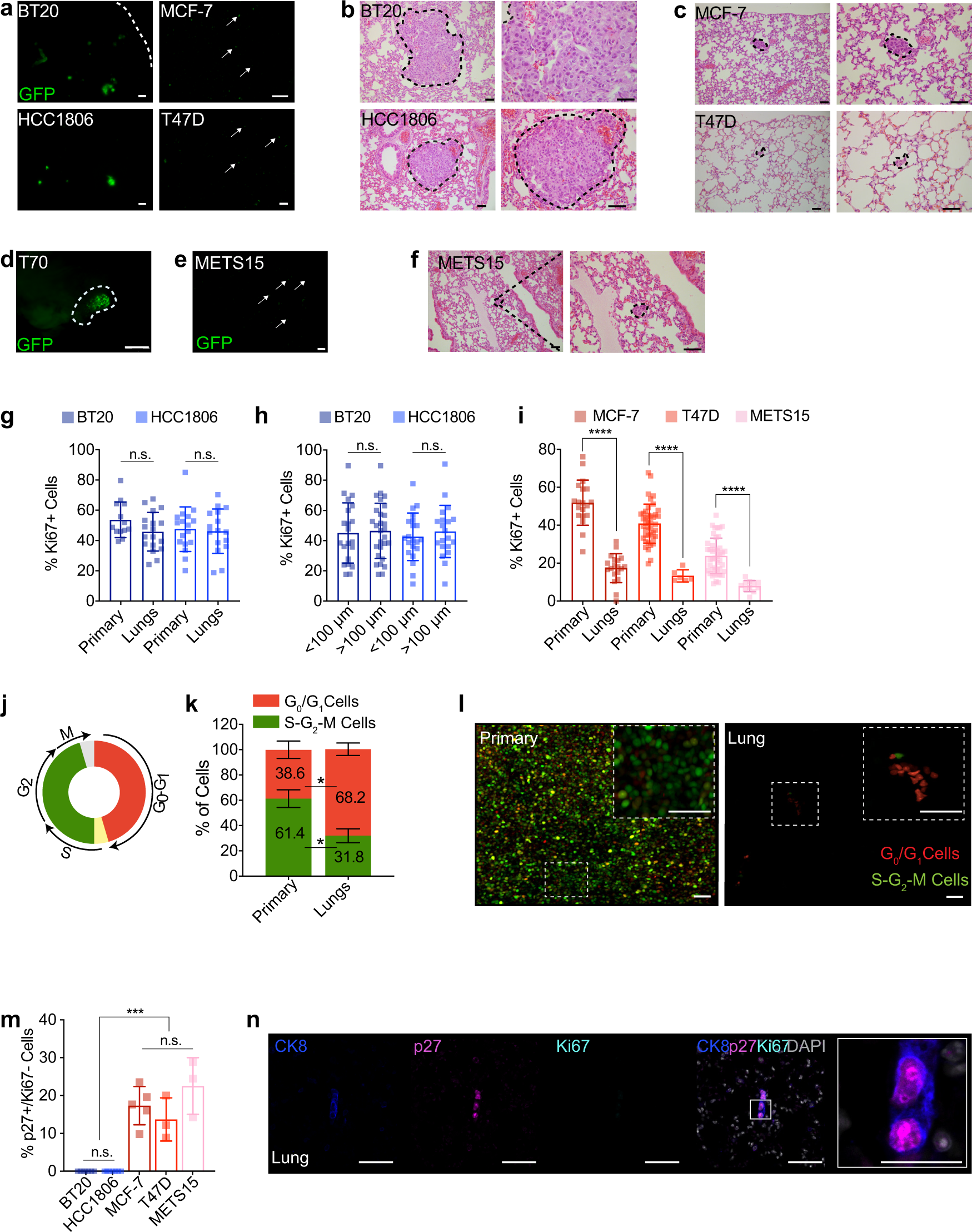 Fig. 2: ER+ metastatic lesions are dormant.