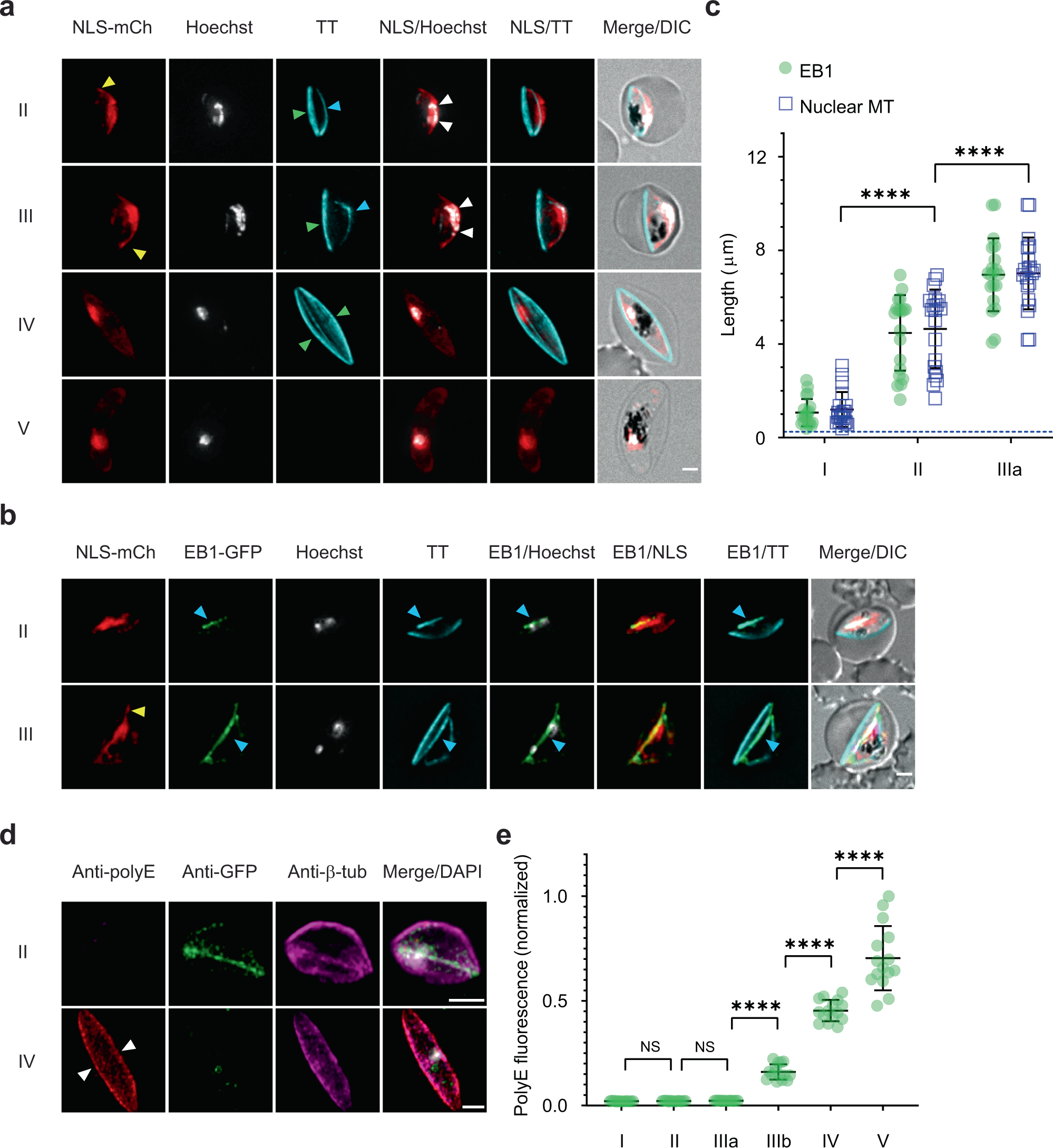 Fig. 2: End-binding protein-1 preferentially associates with the nuclear microtubules, while sub-pellicular microtubules are polyglutamylated.