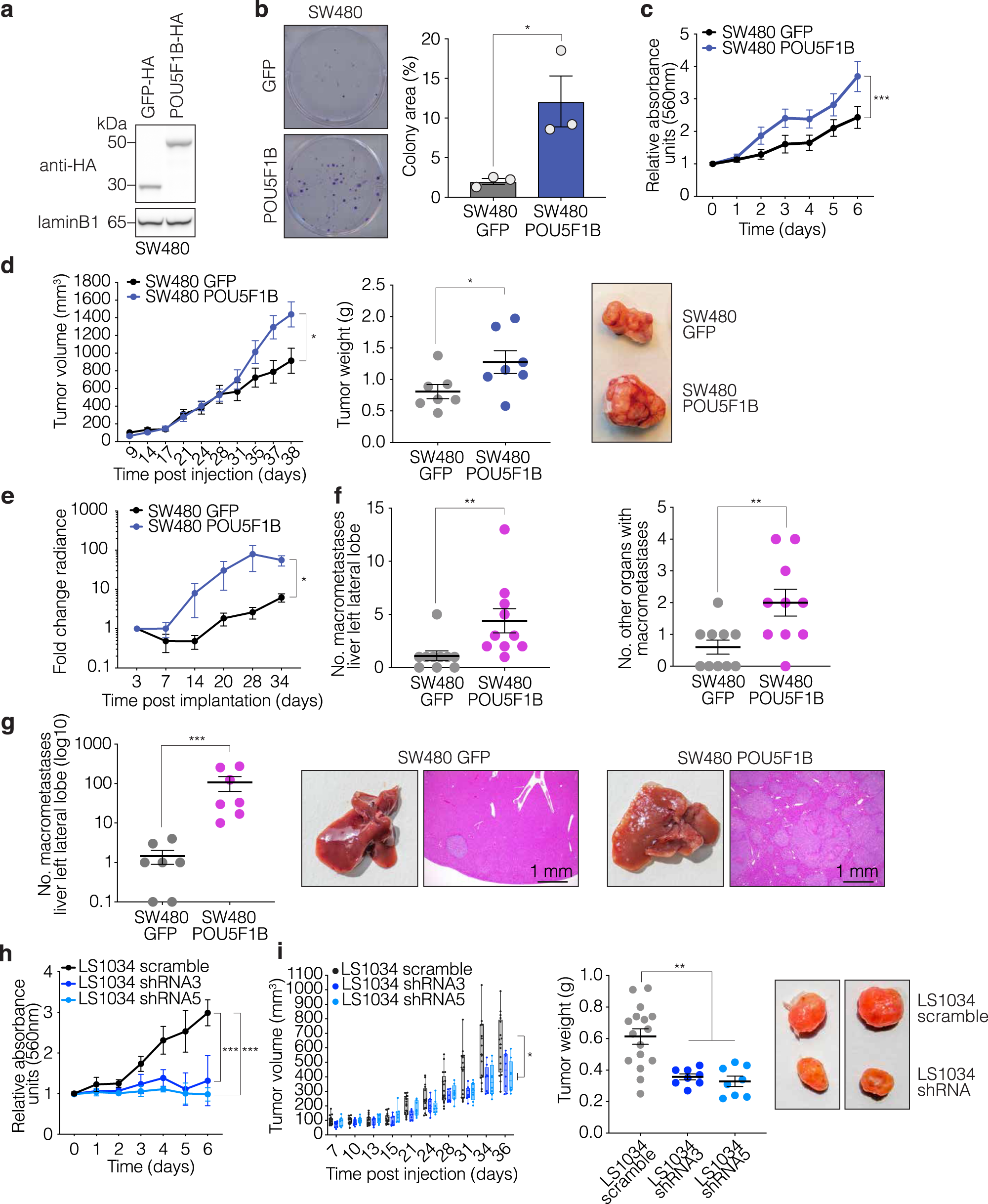 Fig. 2: POU5F1B enhances CRC progression in vitro and in vivo.