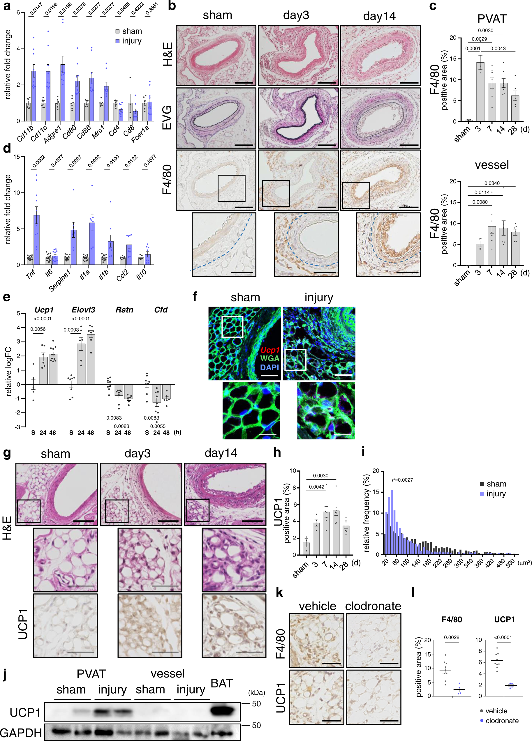 Fig. 1: Endovascular injury-induced macrophage accumulation and inflammation in PVAT followed by upregulation of BAT markers.
