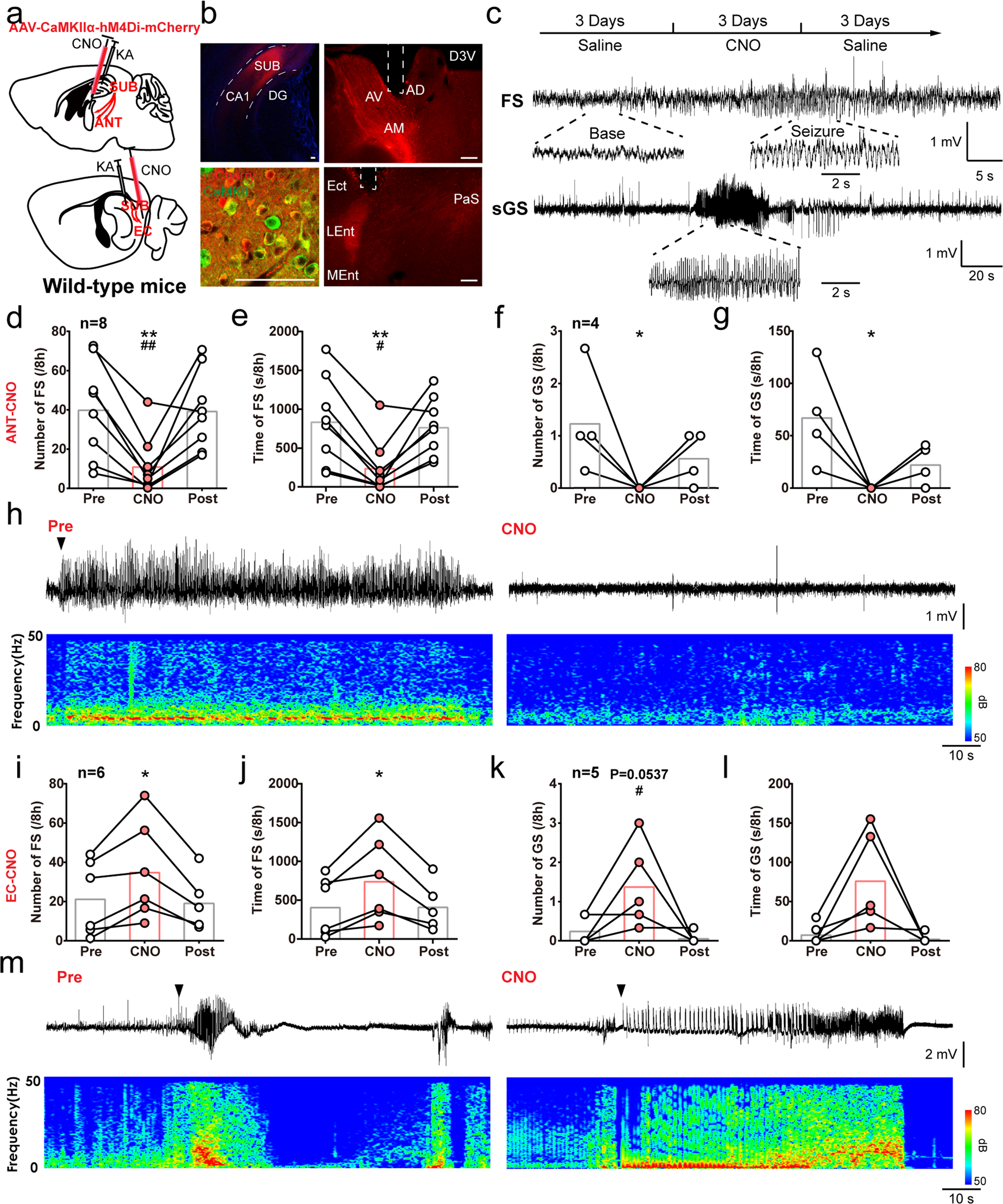 Fig. 4: SUB-ANT and SUB-EC circuits have opposite effects on hippocampal seizures in KA-induced chronic TLE model.