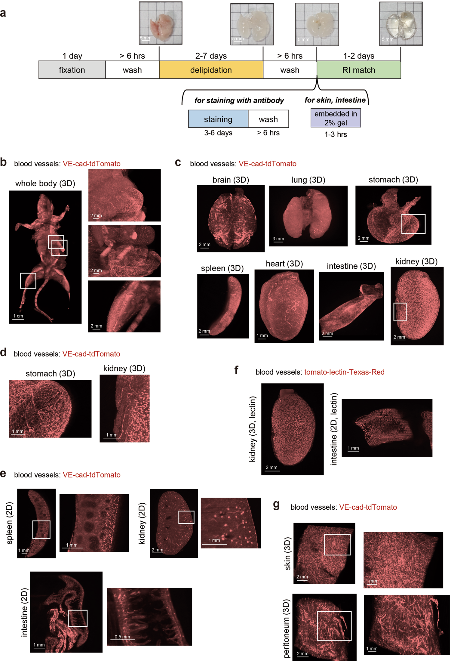 An analysis modality for vascular structures combining tissue-clearing  technology and topological data analysis | Nature Communications