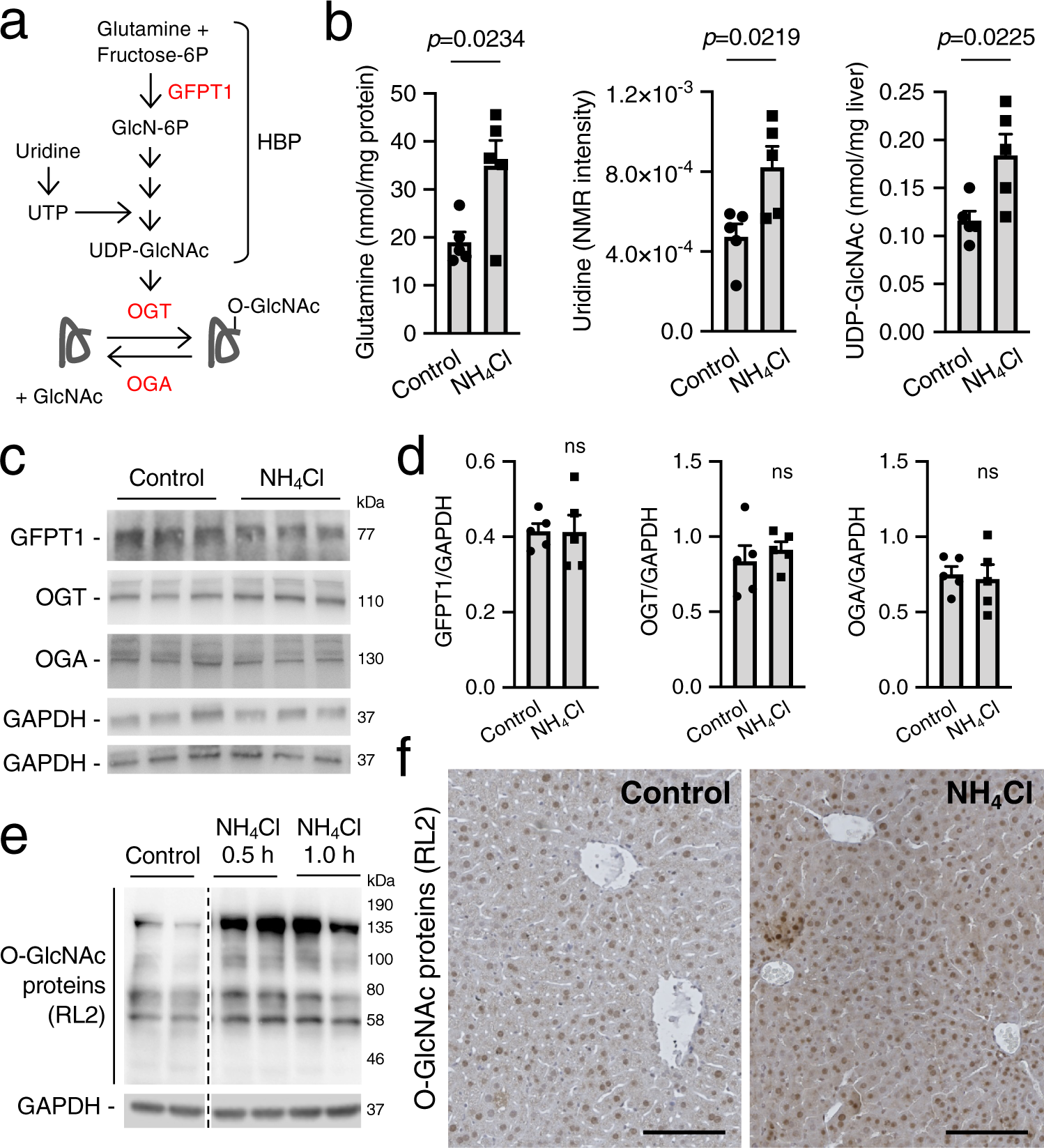 Pharmacological Inhibition of O-GlcNAcase Enhances Autophagy in