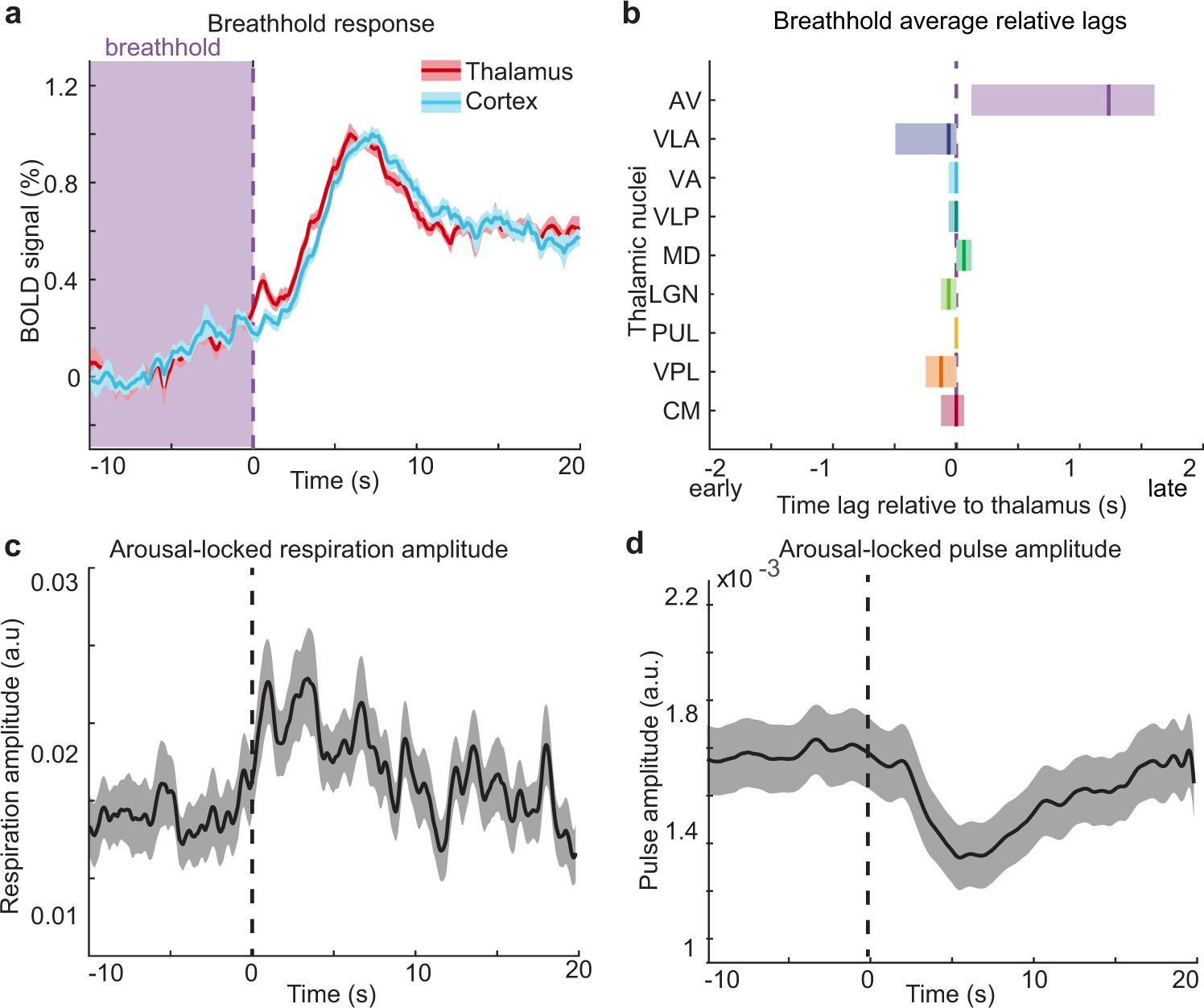Fig. 5: Hemodynamic latencies cannot explain the arousal-locked temporal dynamics in the thalamus.