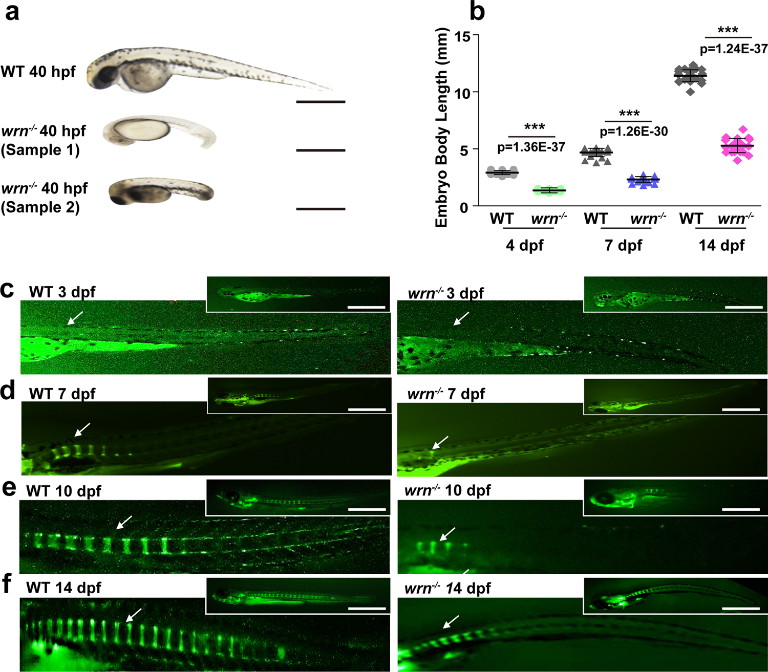WRN promotes bone development and growth by unwinding SHOX-G-quadruplexes  via its helicase activity in Werner Syndrome | Nature Communications
