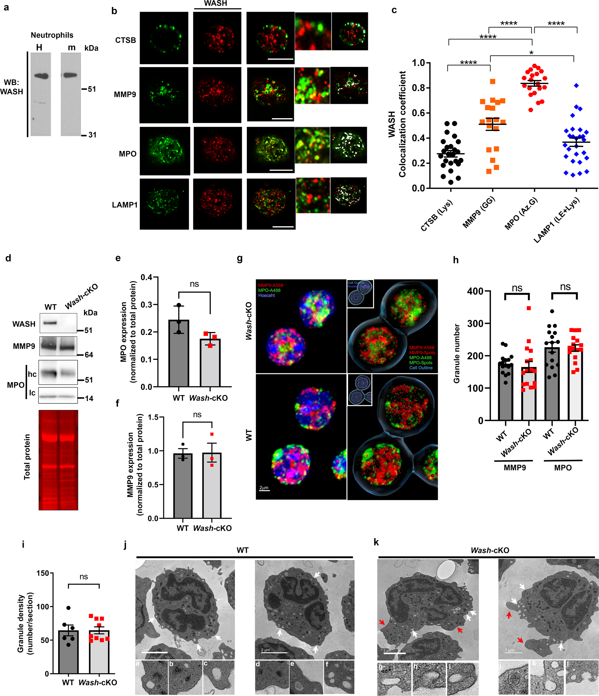 Differential Dysregulation Of Granule Subsets In Wash Deficient Neutrophil Leukocytes Resulting In Inflammation Nature Communications Differential Dysregulation Of Granule Subsets In Wash Deficient Neutrophil Leukocytes Resulting In Inflammation Nature Communications