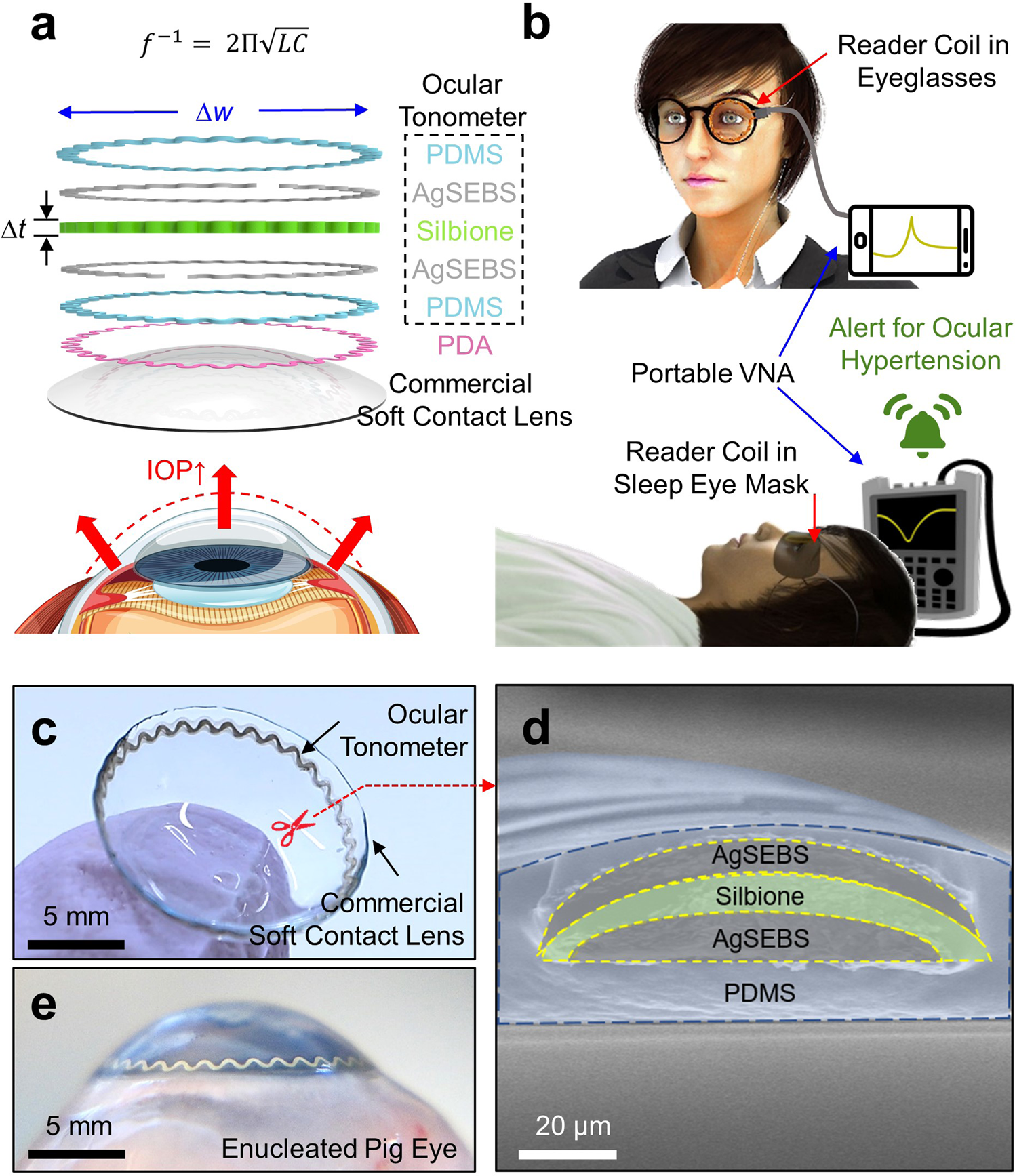 Smart soft contact lenses for continuous 24-hour monitoring of intraocular  pressure in glaucoma care | Nature Communications