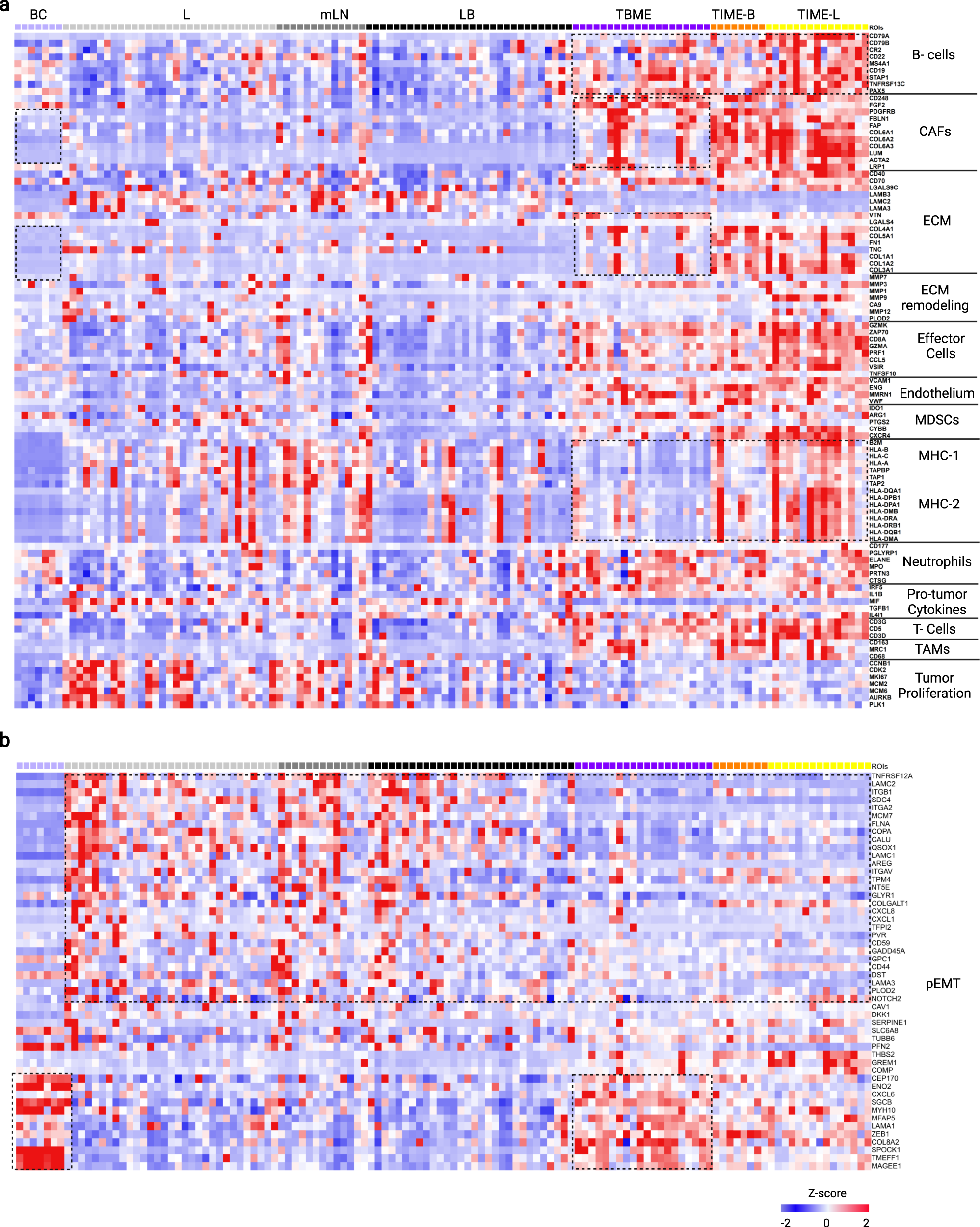 Fig. 3: Spatially resolved functional gene signatures of lung cancer metastasis.