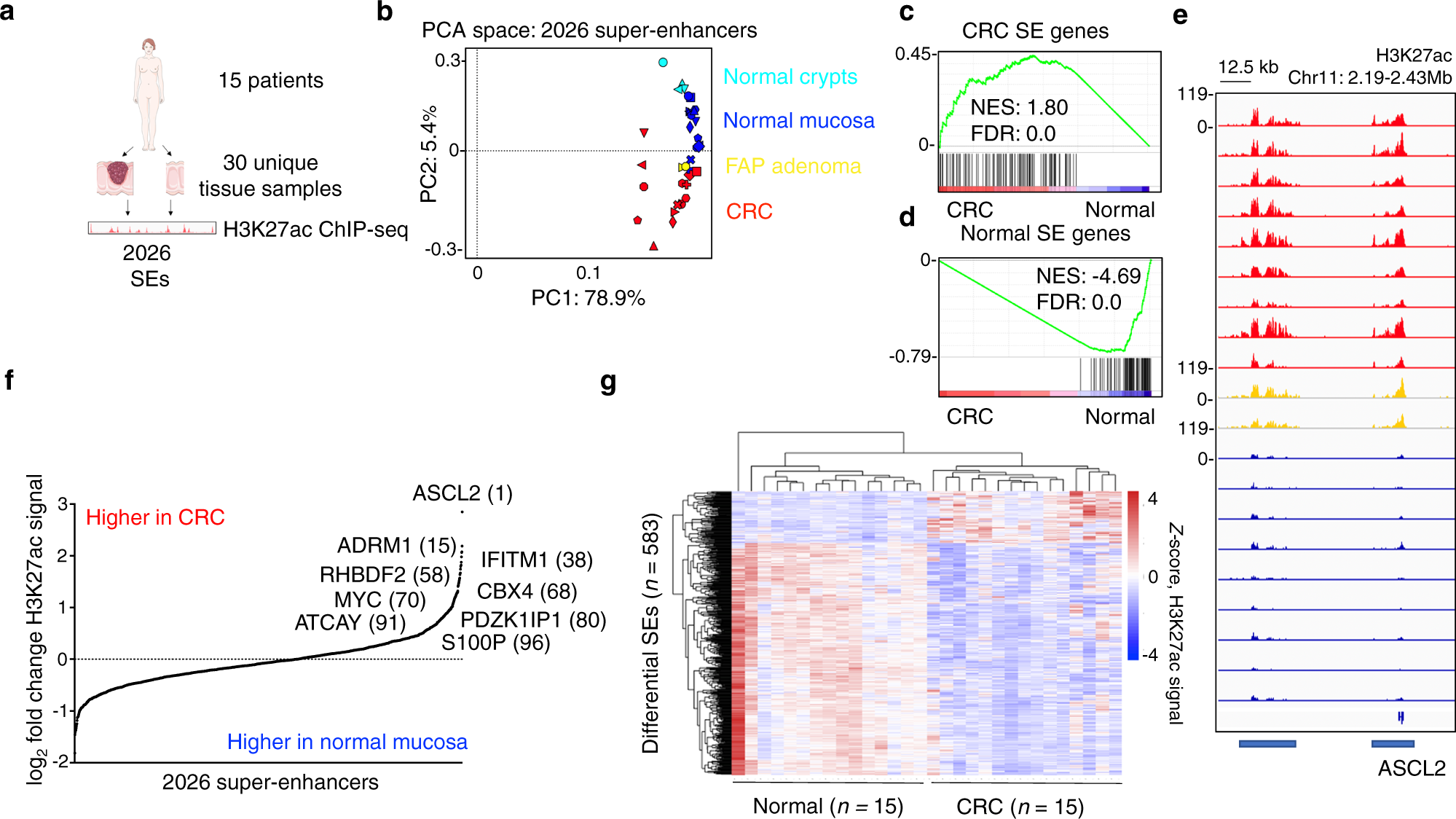 Fig. 1: Recurrently dysregulated super-enhancers in CRC patients.
