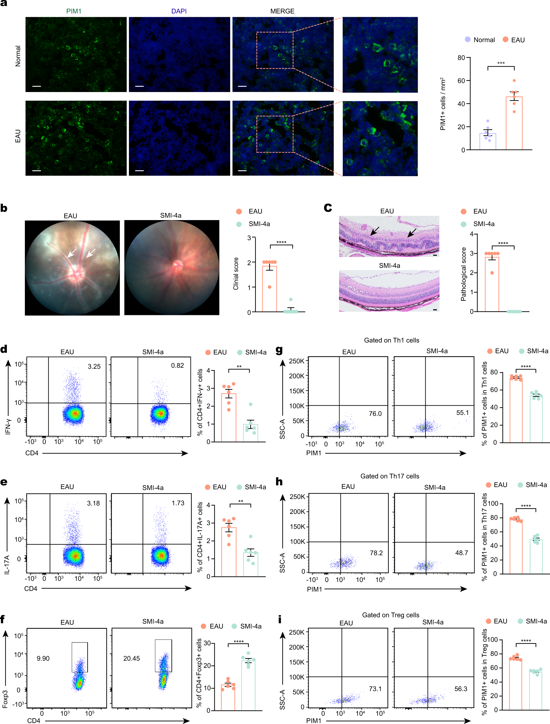 Fig. 3: Inhibiting PIM1 alleviated EAU.
