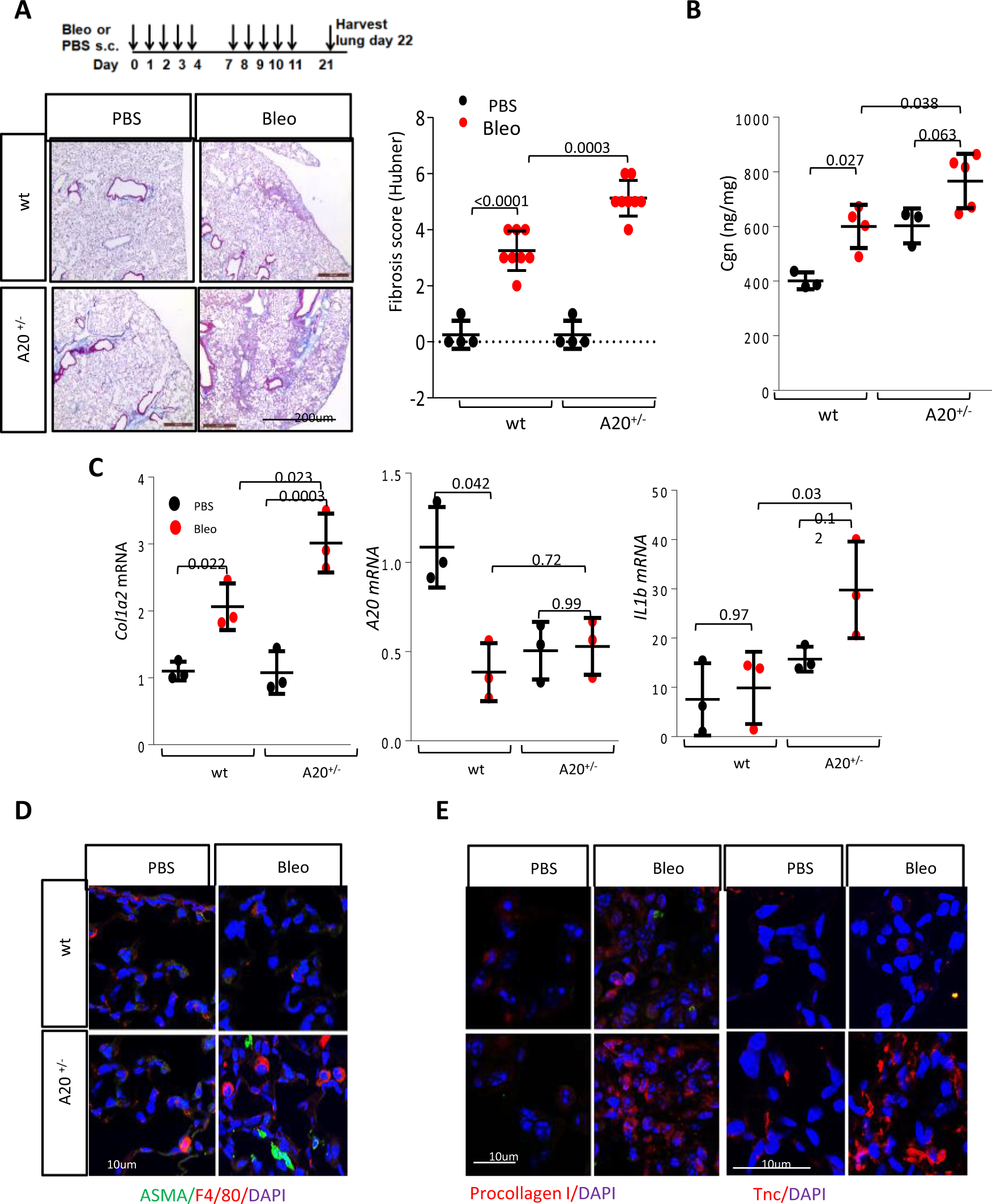Fig. 3: A20+/− mice showed exaggerated lung fibrosis.