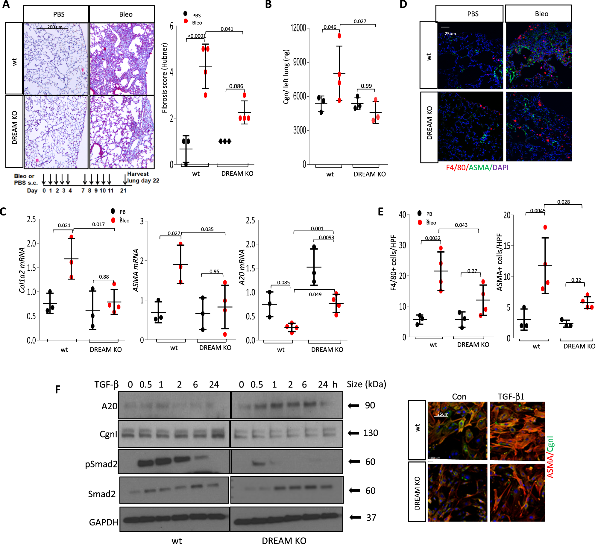 Fig. 7: DREAM-/- mice showed attenuated lung fibrosis.