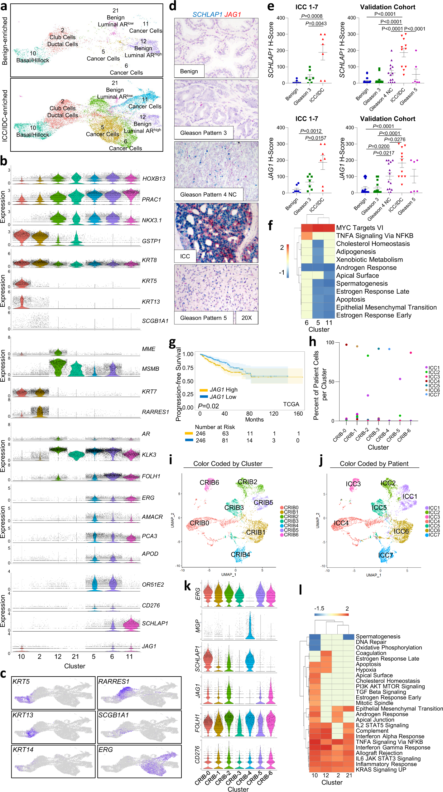 Fig. 3: Increased SCHLAP1 and JAG1 in prostate ICC/IDC.