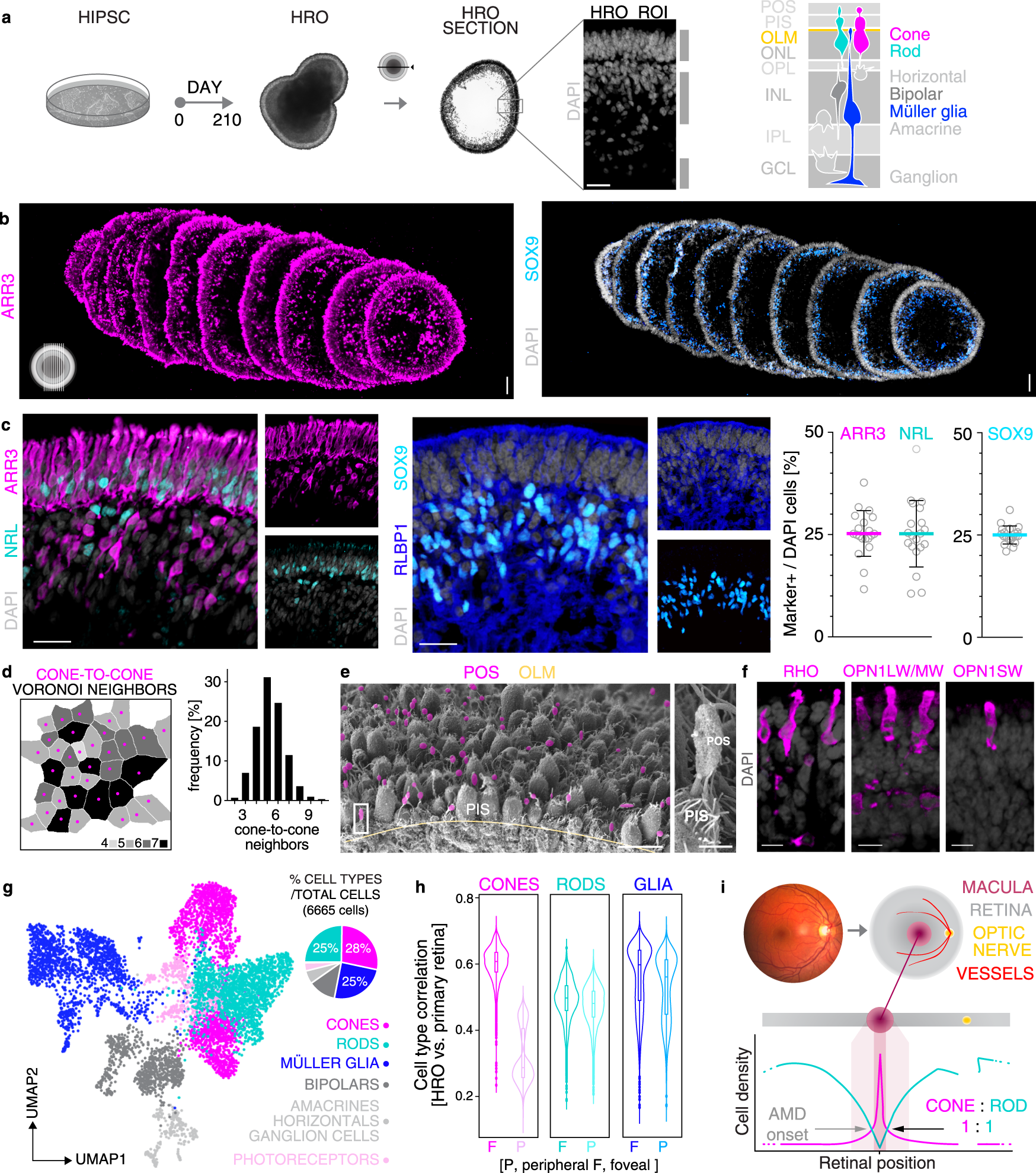 HBEGF-TNF induce a complex outer retinal pathology with photoreceptor cell  extrusion in human organoids | Nature Communications