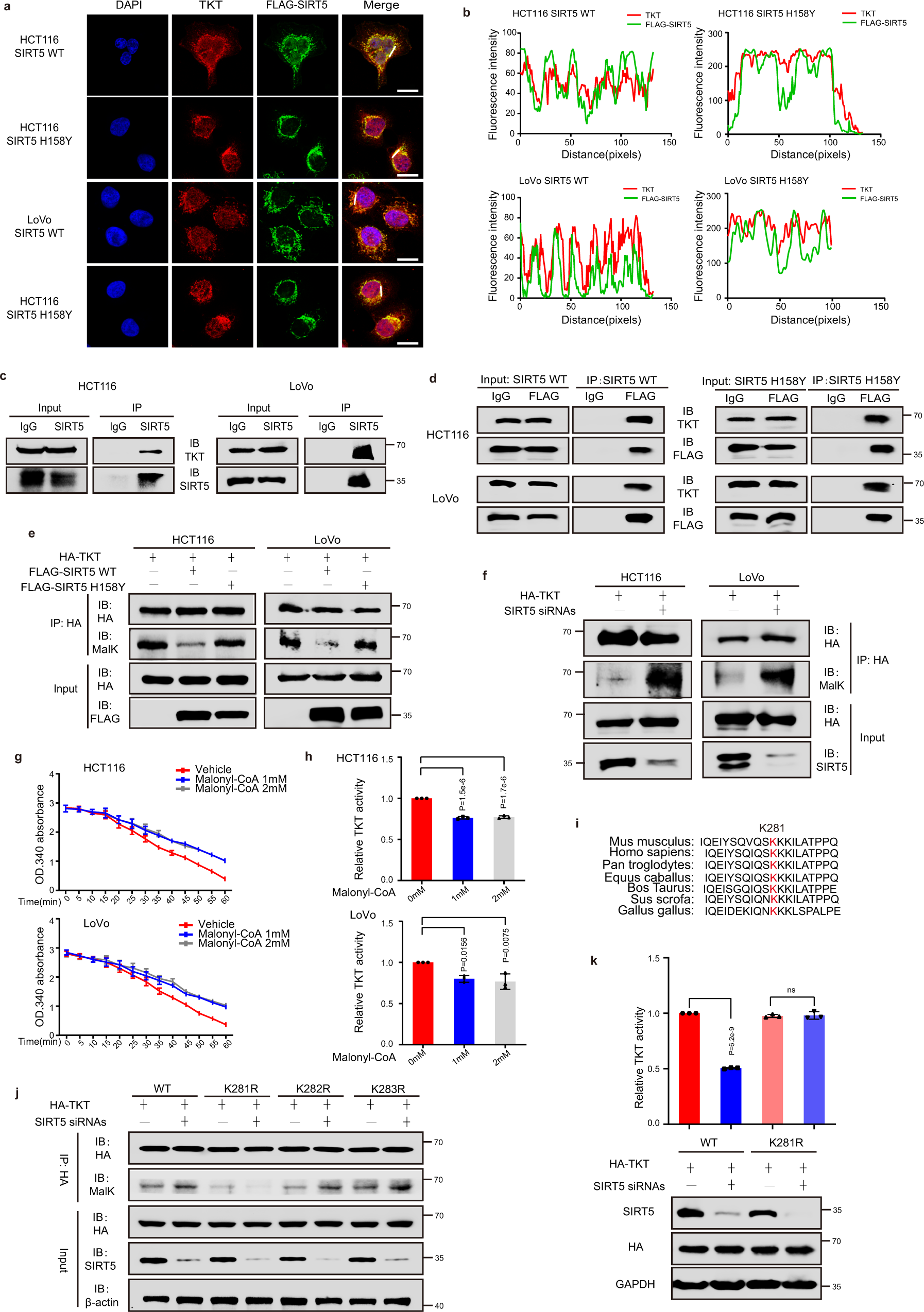 Fig. 6: SIRT5 activates TKT by mediating its demalonylation.