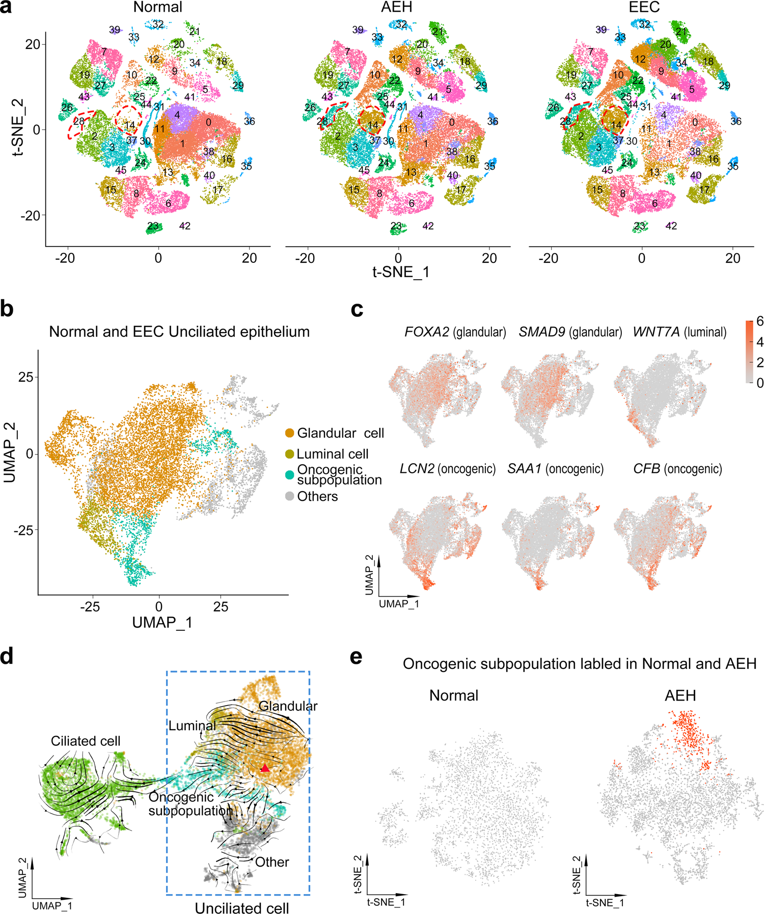 Fig. 3: Unciliated glandular epithelium is the source of endometrial carcinoma.