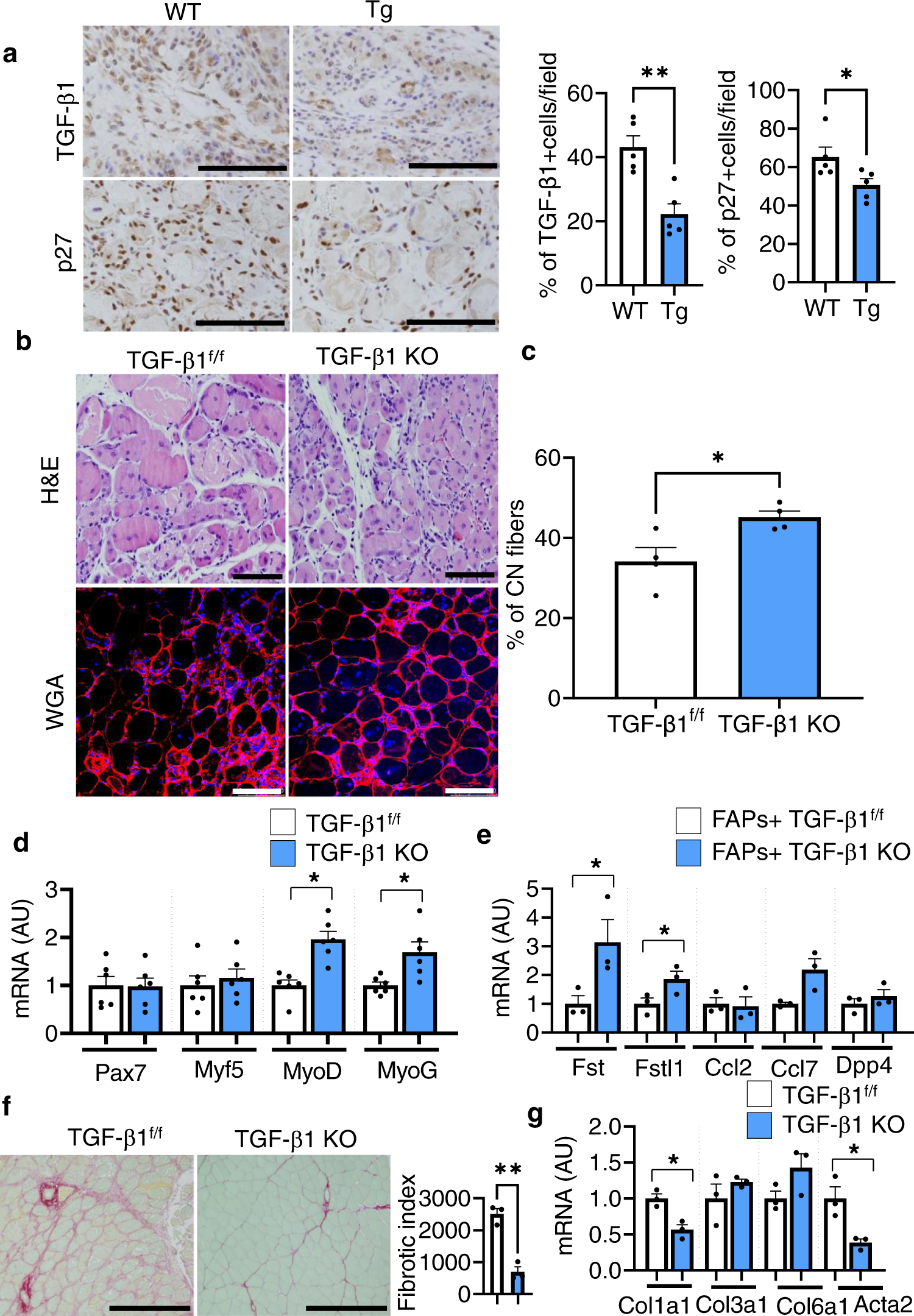Fig. 4: Depletion of CD206+ M2-like MΦ reduces TGF-β signaling and improves muscle recovery.
