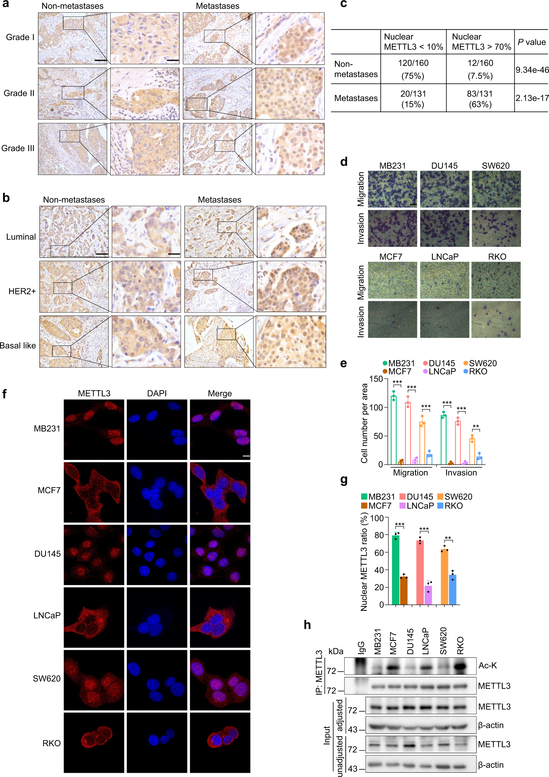 METTL3 acetylation impedes cancer metastasis via fine-tuning its nuclear  and cytosolic functions