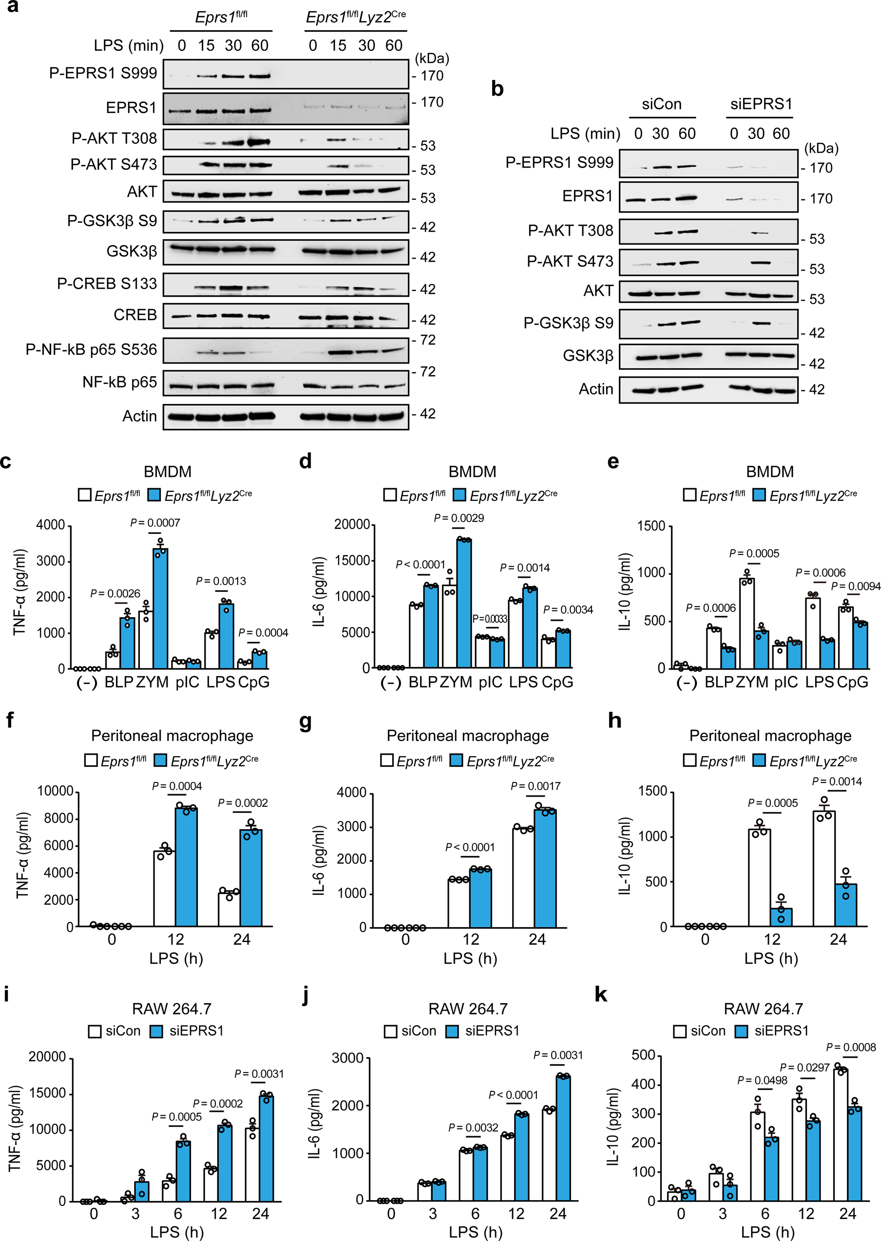 Fig. 5: EPRS1 negatively regulates inflammation in TLR-stimulated macrophages.