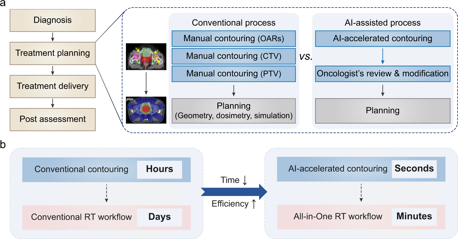 Automated liver tissues delineation techniques: A systematic