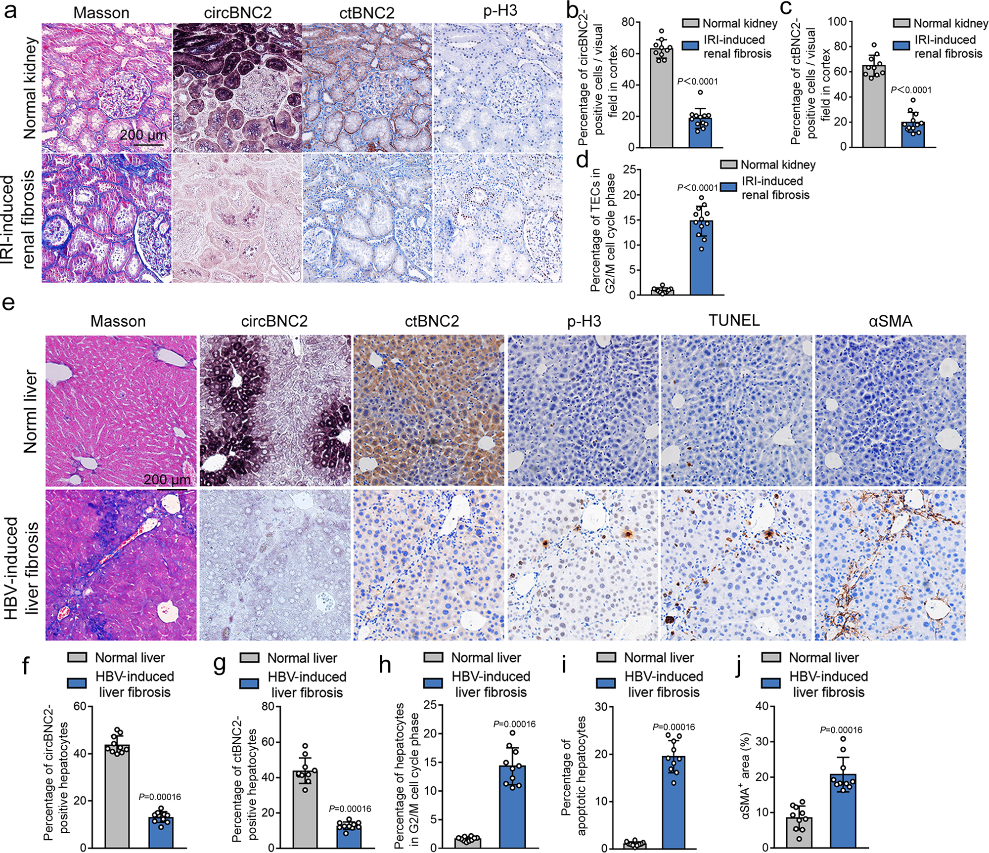 Fig. 7: Downregulation of circBNC2 and ctBNC2 associates with epithelial cell G2/M arrest in human fibrotic kidney and liver.