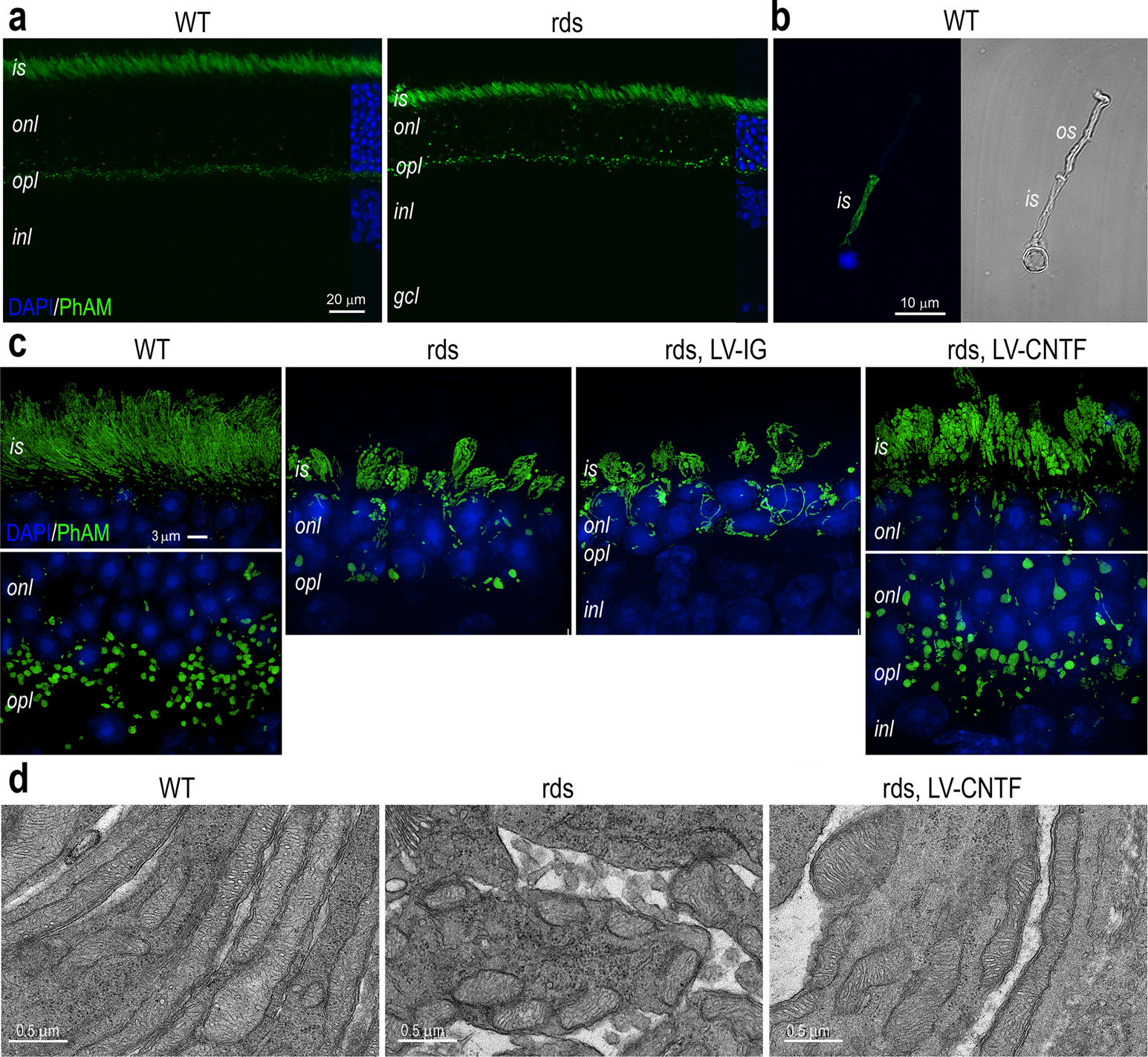 Fig. 1: CNTF-induced mitochondrial morphological changes in rod photoreceptors.