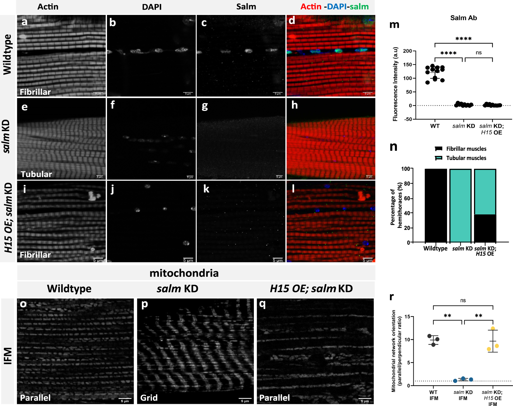 Fig. 5: H15 is downstream of salm and H15 OE rescues fiber-type switching in salm KD fibers.