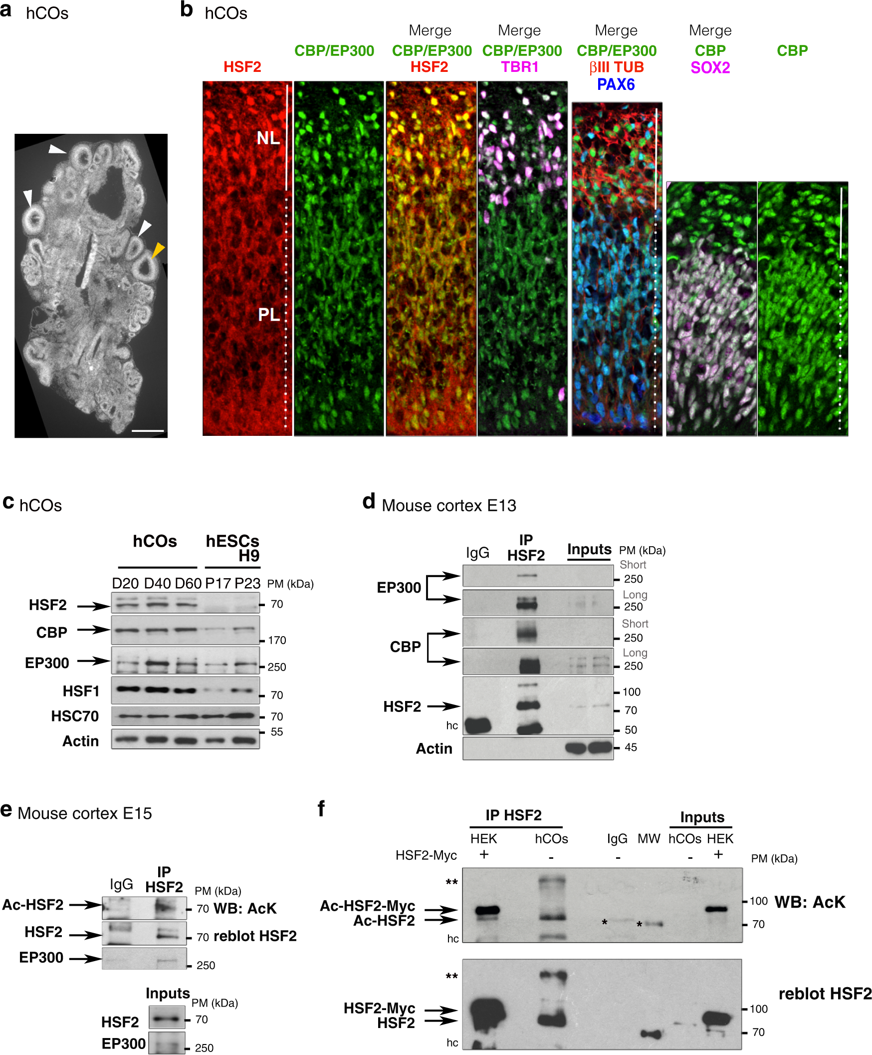 Rubinstein–Taybi syndrome: clinical and molecular overview