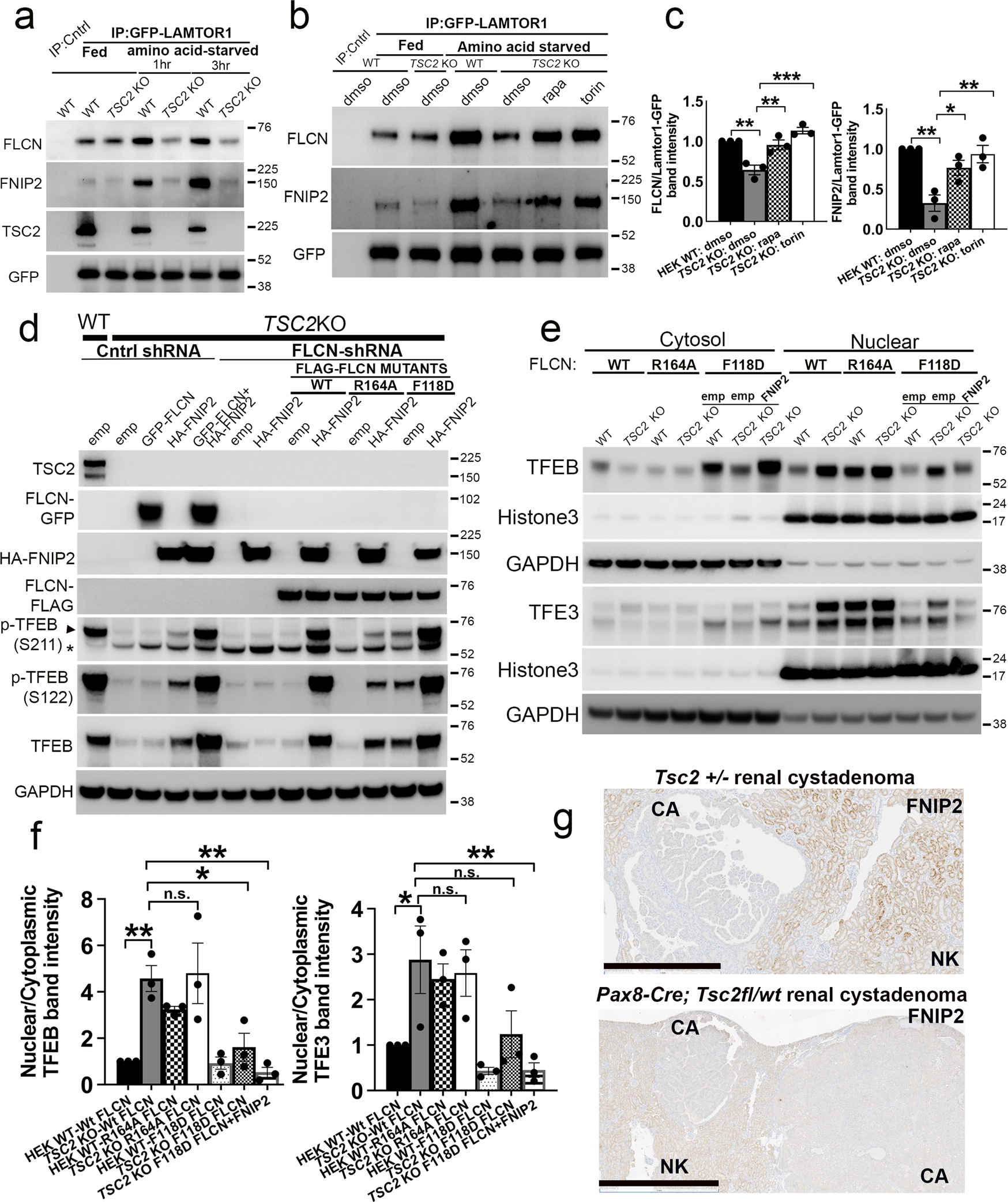 Fig. 7: Restoration of FLCN:FNIP2 lysosomal localization by mTORC1 inhibition or co-expression of FLCN and FNIP2 fully rescues TFEB phosphorylation in cells with TSC2 loss.