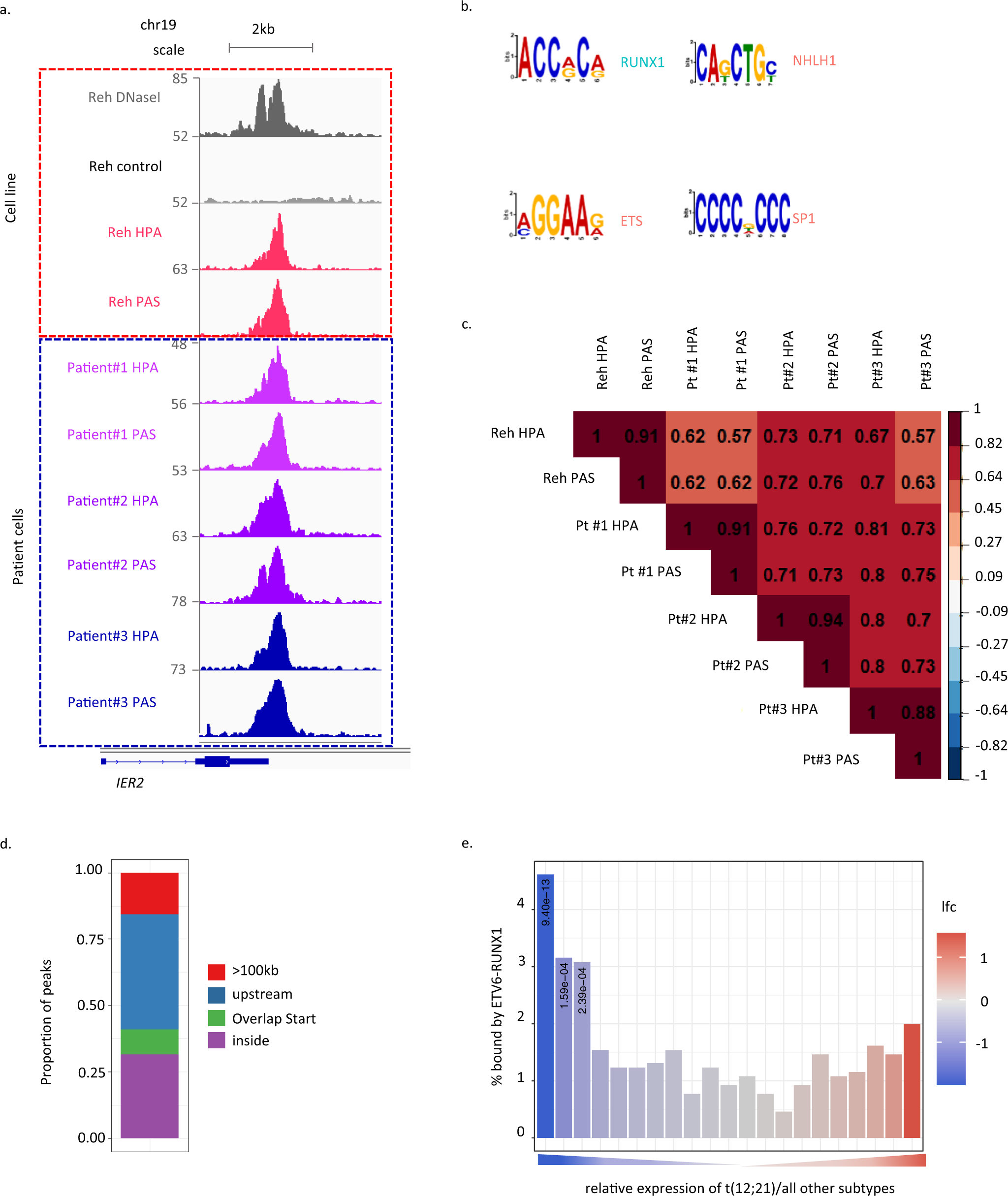 Fig. 1: Delineating the ETV6-RUNX1 regulome in childhood B-ALL.