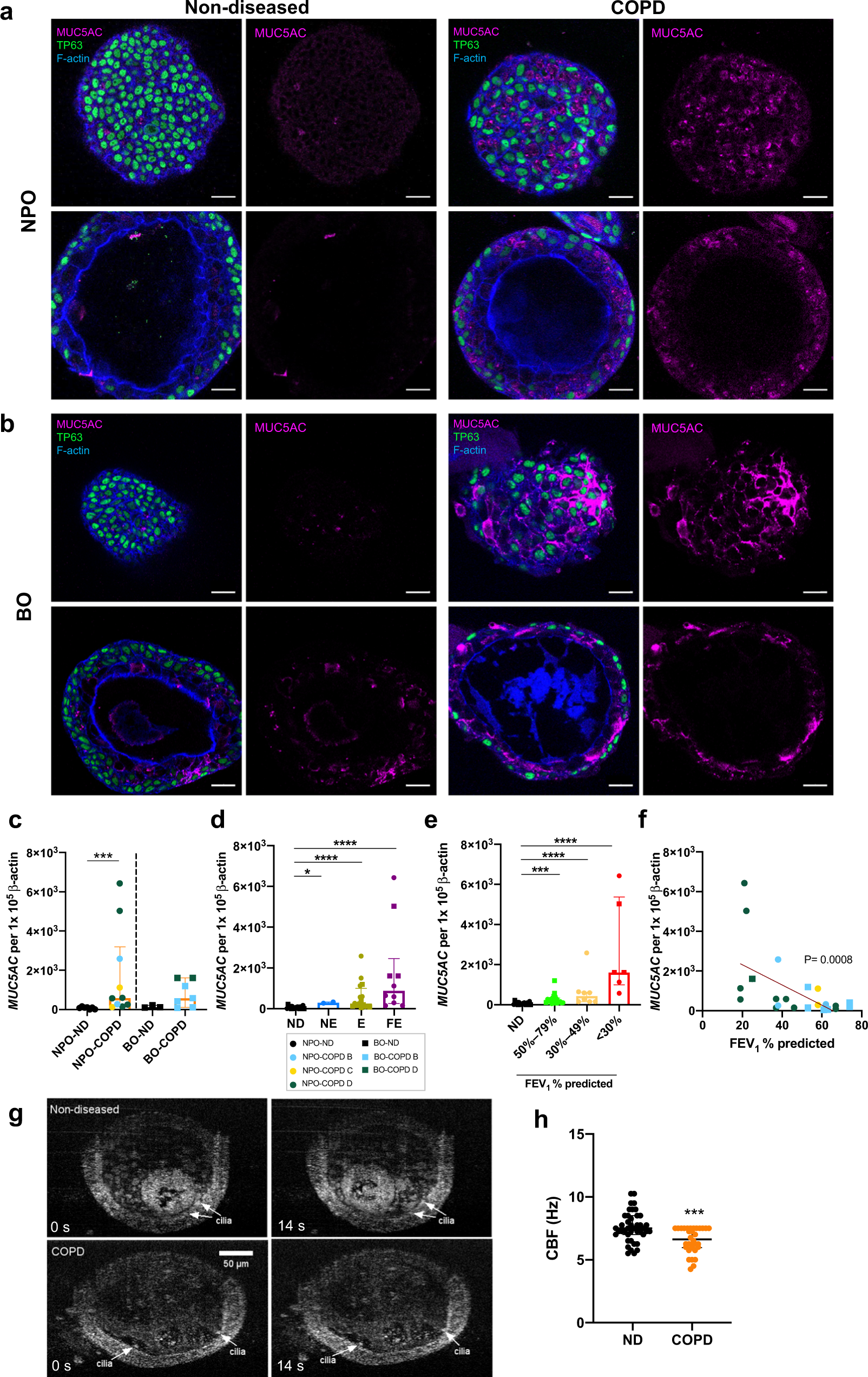 Fig. 2: Nasopharyngeal and bronchial organoids from individuals with COPD demonstrate high MUC5AC expression and goblet cells.