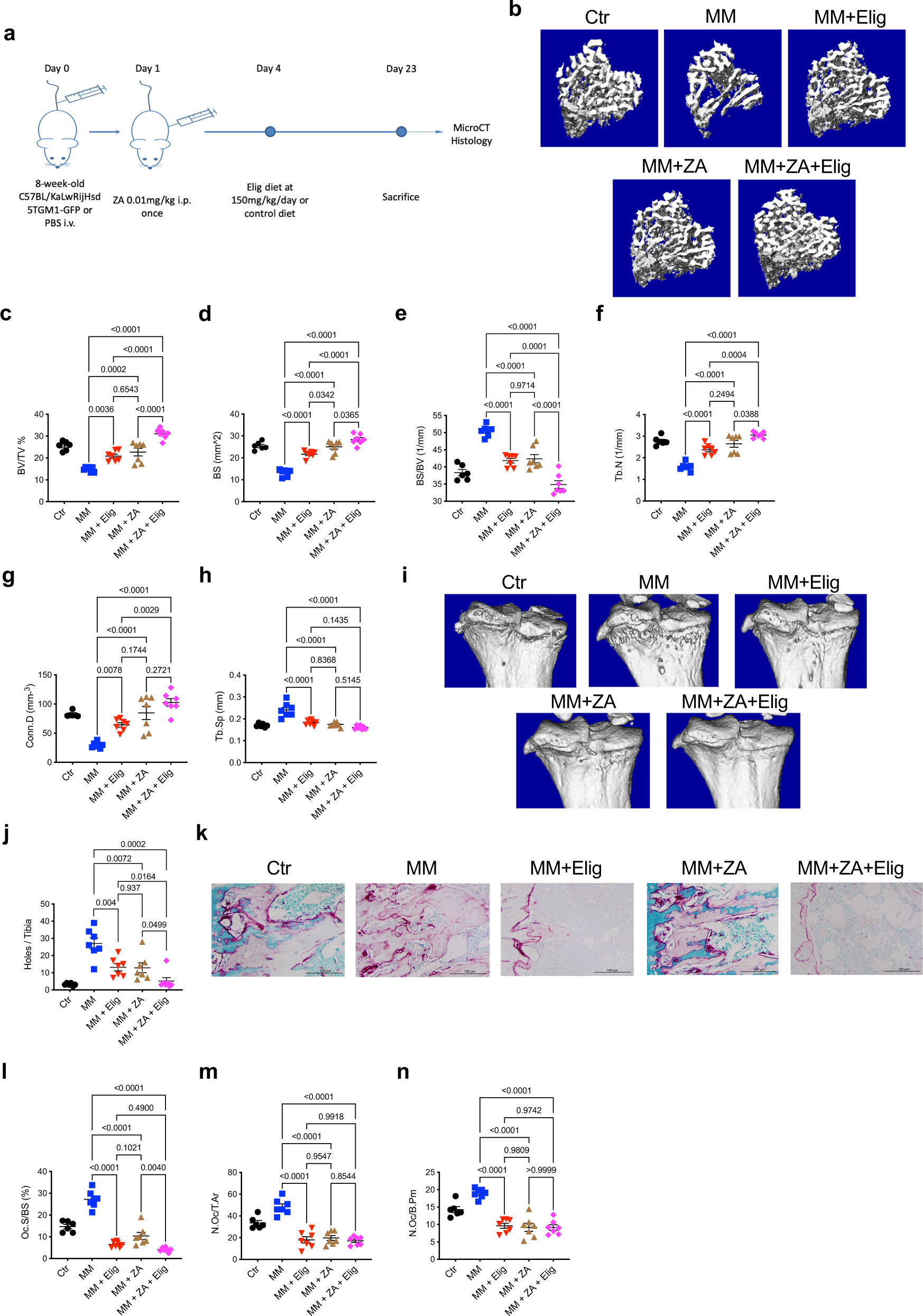 Fig. 4: Eliglustat combined with ZA reduces MM bone disease with greater effect than either agent alone.