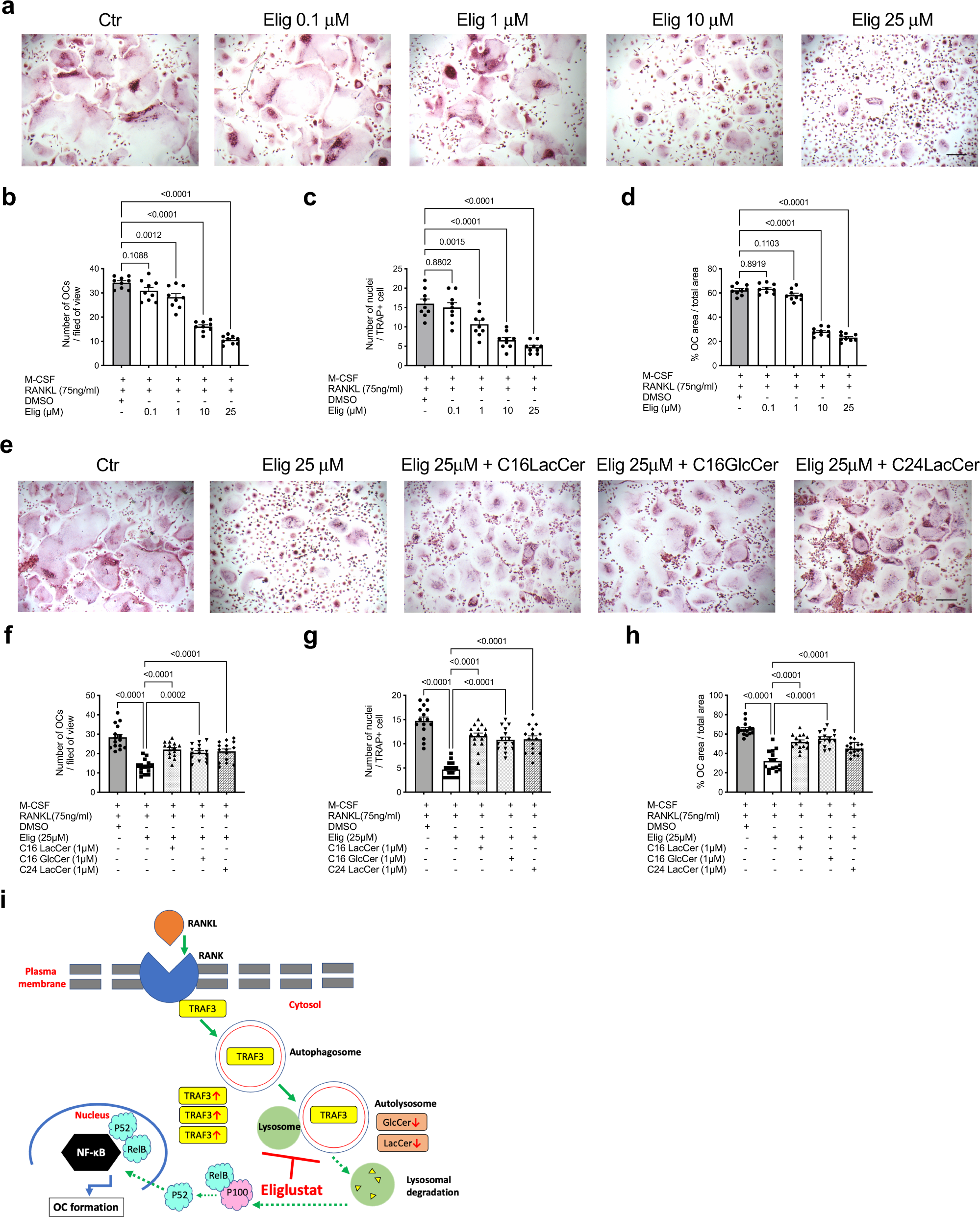 Fig. 8: Eliglustat inhibits OC formation from MM patients while exogenous GSLs reverse eliglustat inhibition.