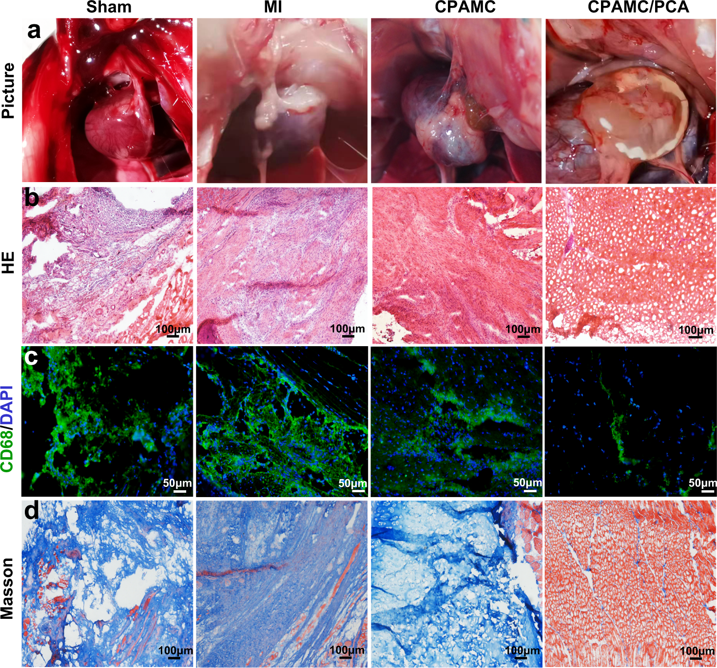 Fig. 8: Evaluation of anti-adhesion function of CPAMC/PCA hydrogel in MI rat model.