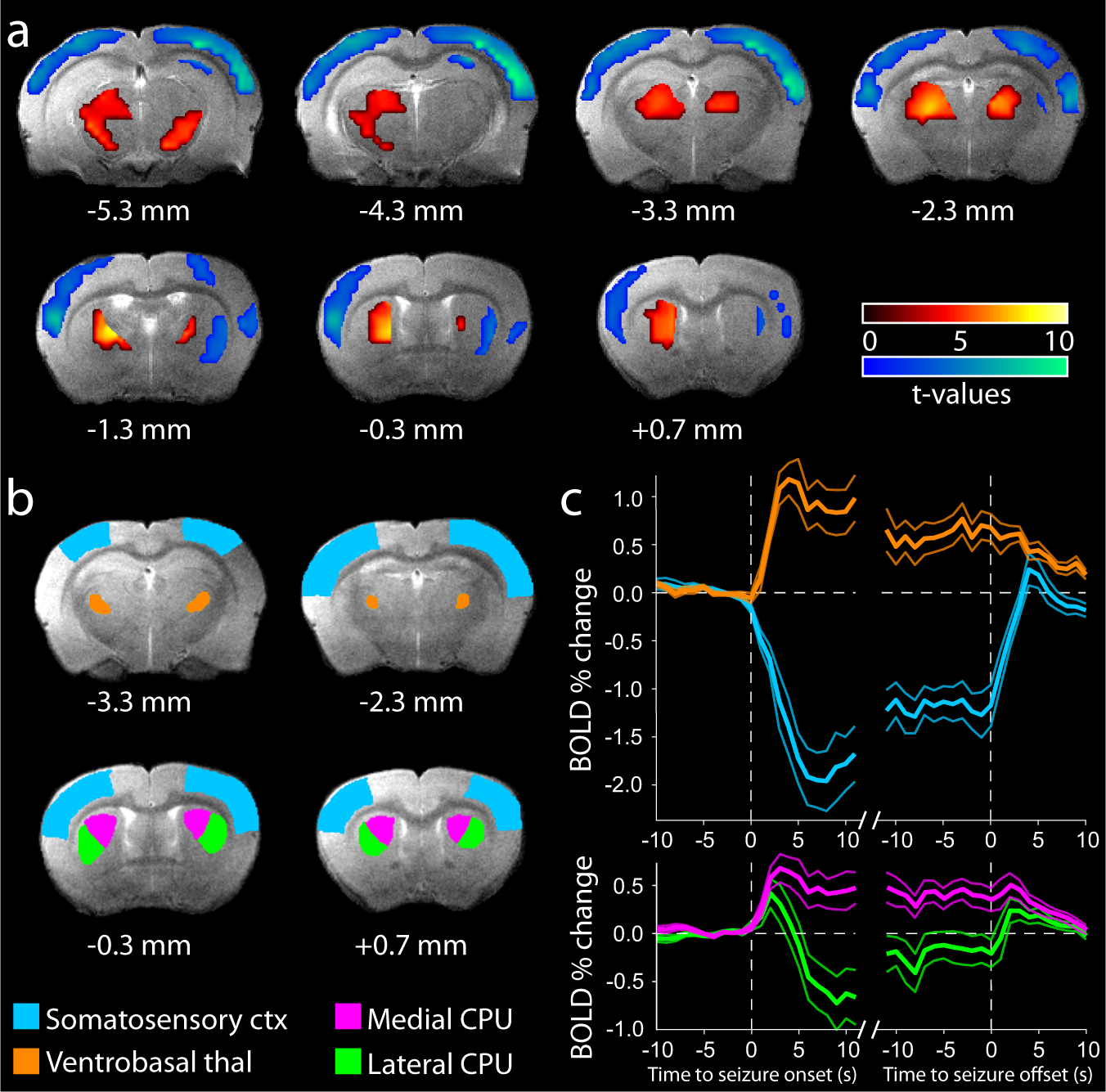 Decreased but diverse activity of cortical and thalamic neurons in  consciousness-impairing rodent absence seizures | Nature Communications